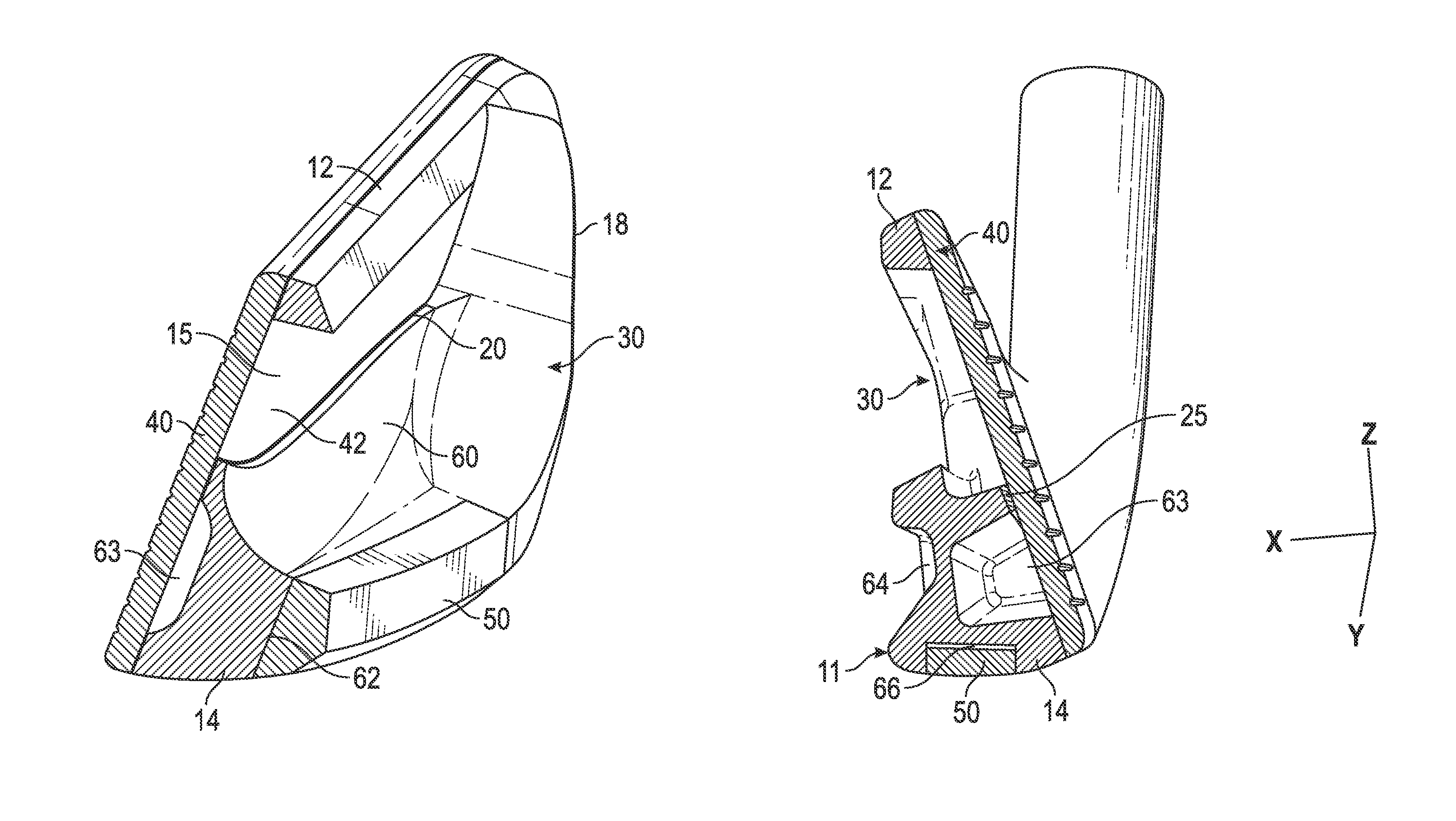 Iron-type golf club head