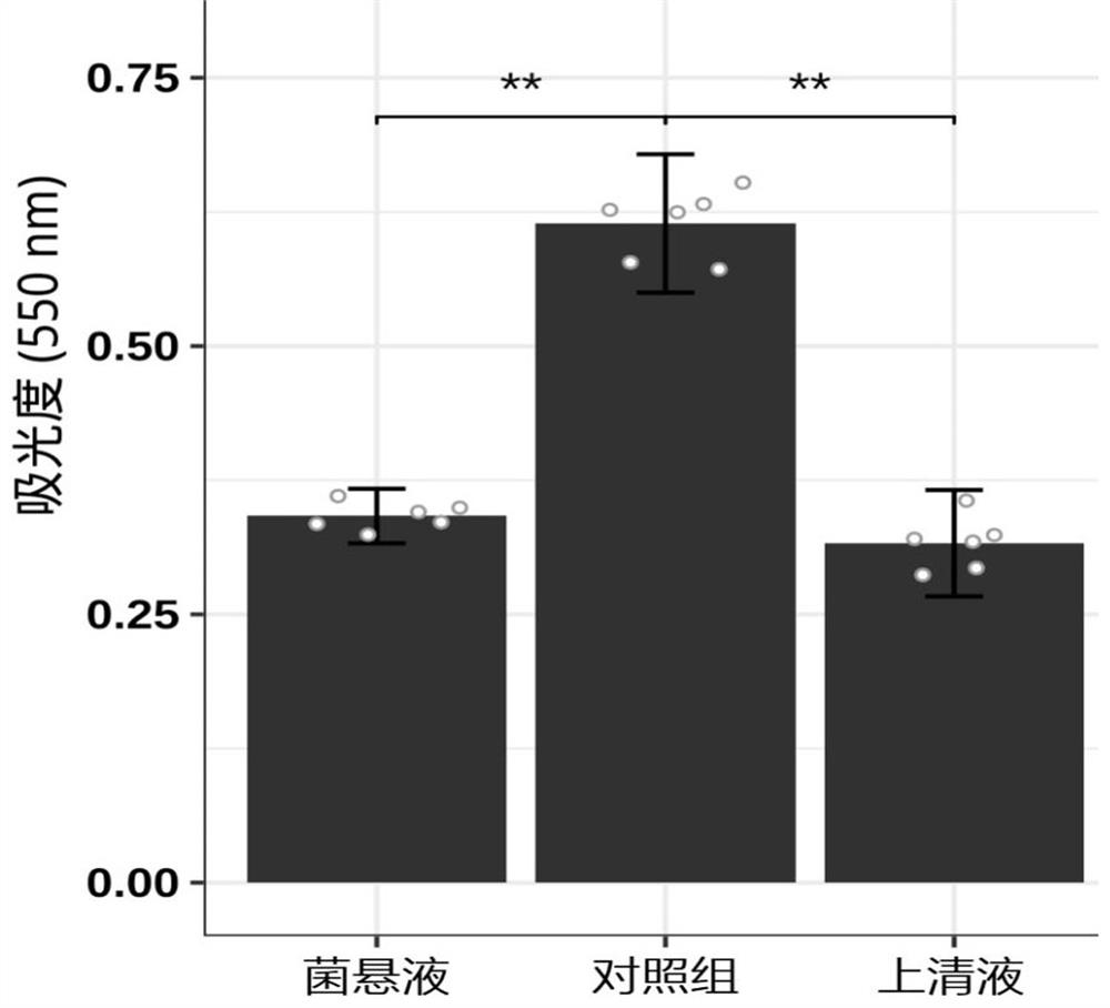 A kind of Lactobacillus plantarum against Helicobacter pylori infection and its application