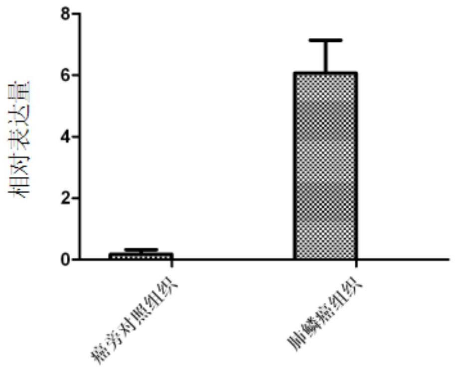 A retrotransposable gene l1-fggy and its use as a marker for lung squamous cell carcinoma