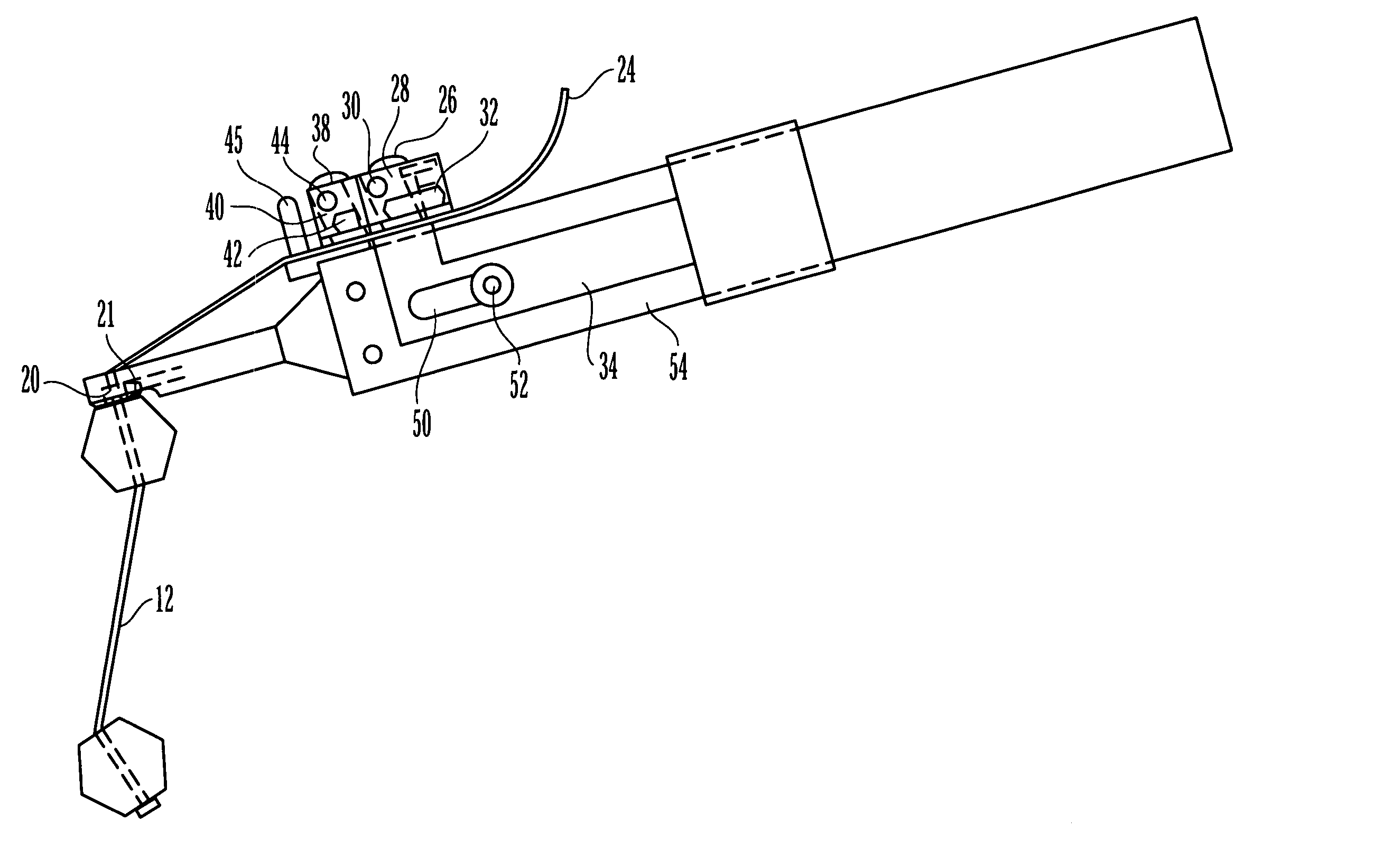 Sternal reconstruction system