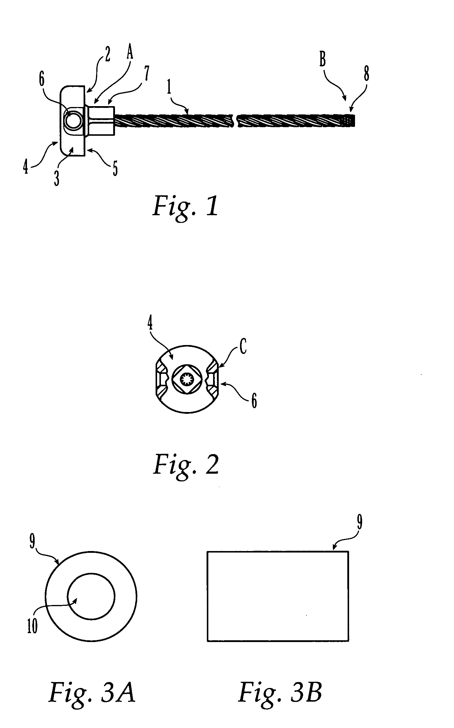 Sternal reconstruction system