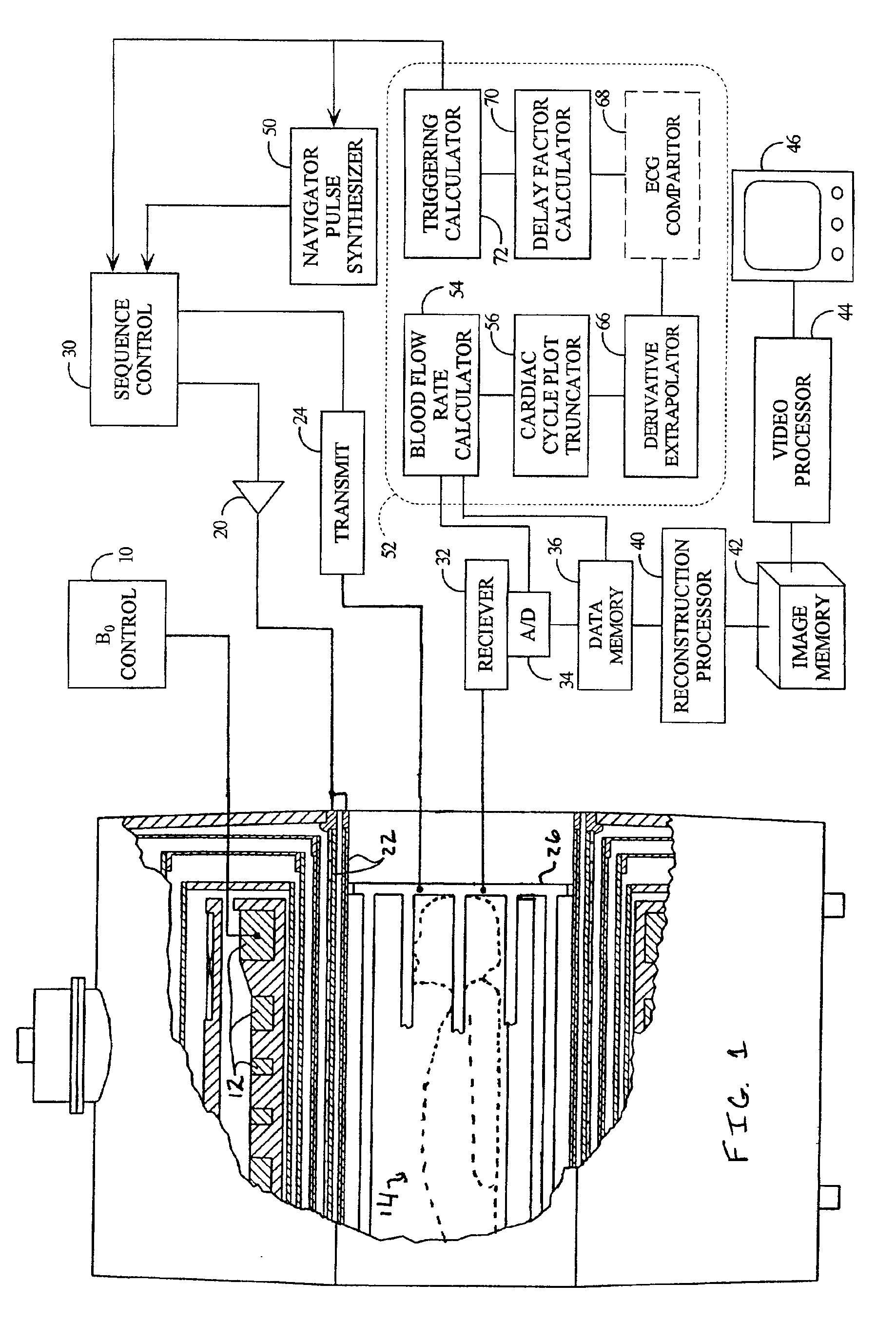 Blood flow gated MRI