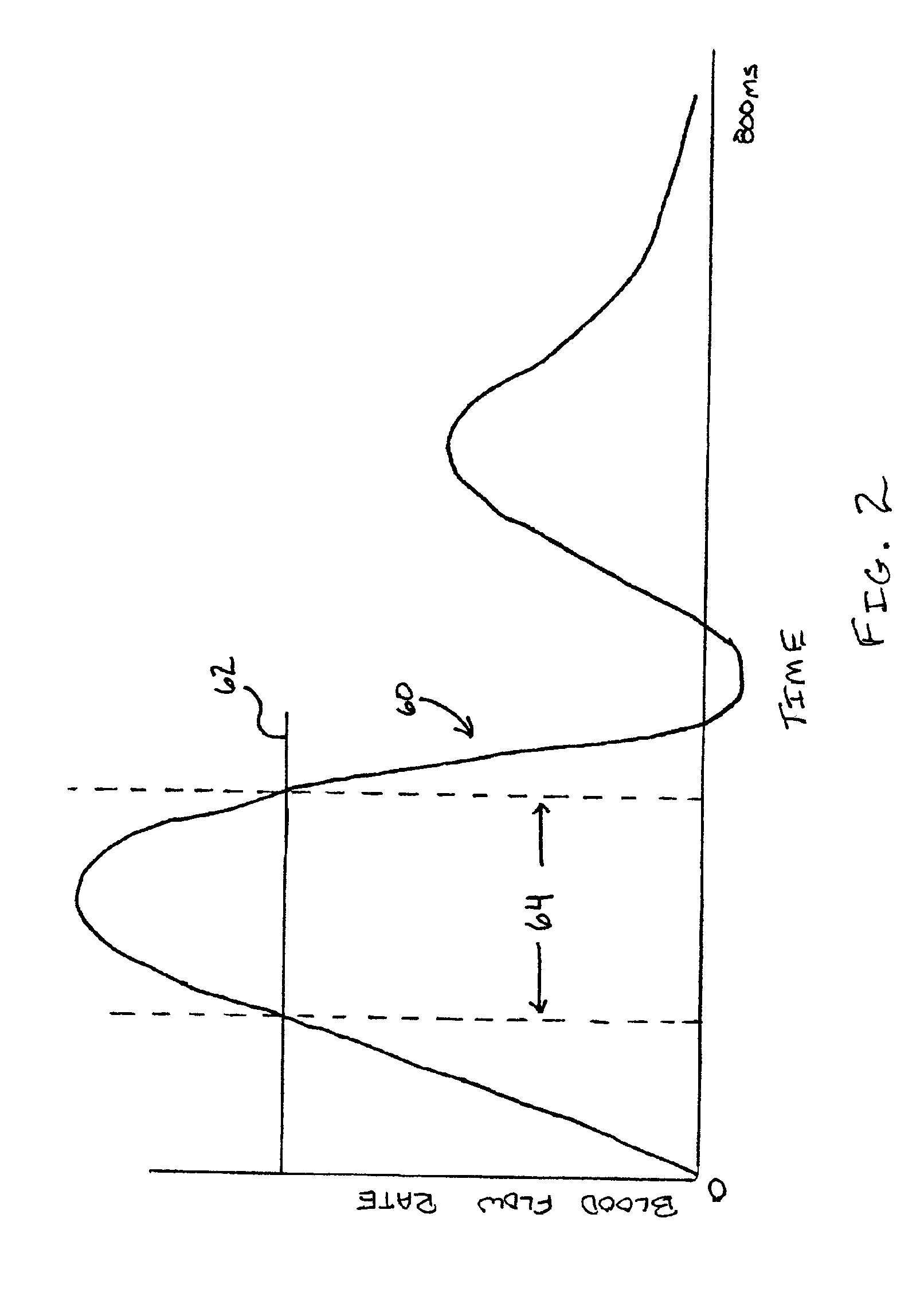 Blood flow gated MRI