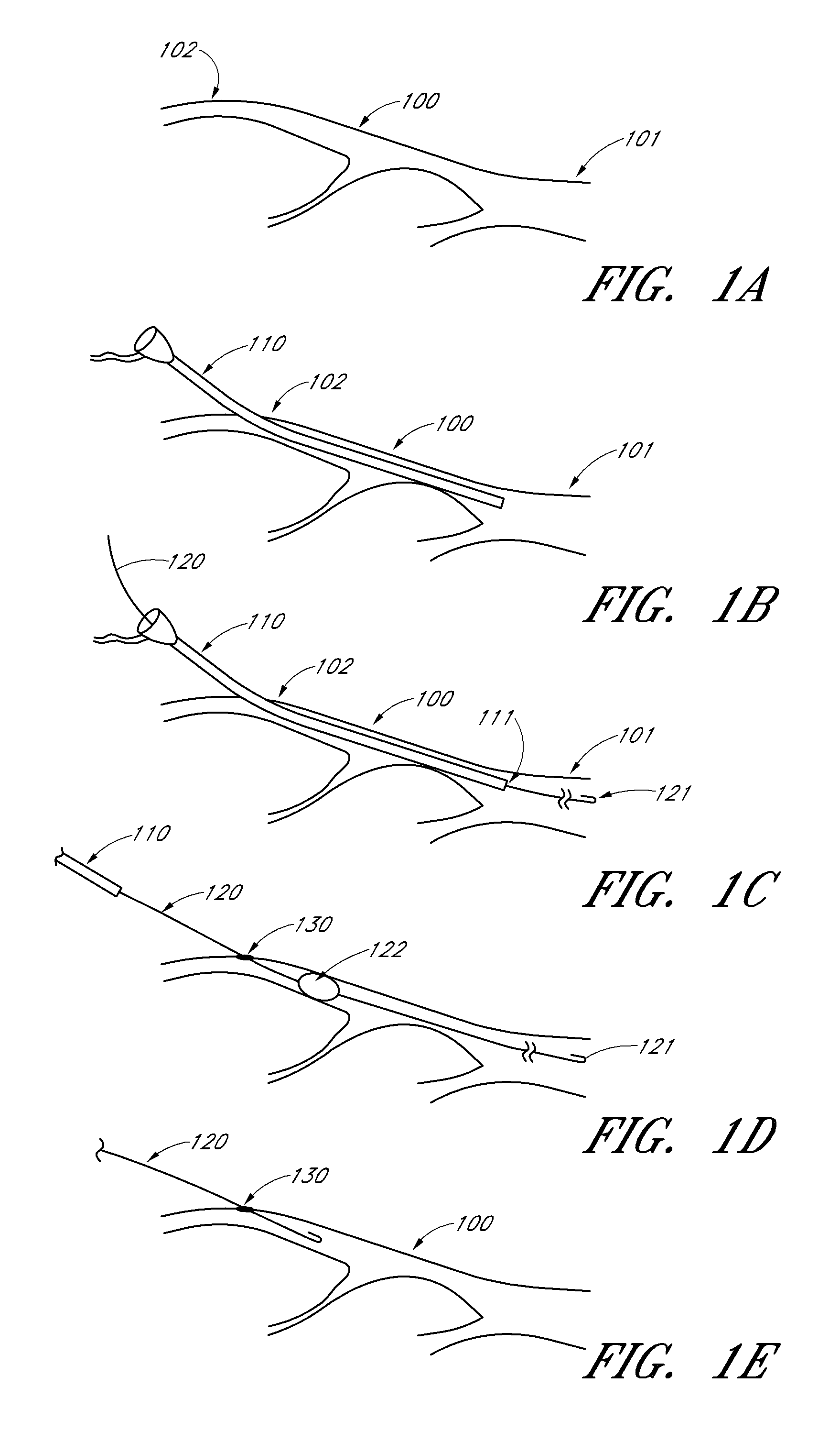 Method and devices for flow occlusion during device exchanges