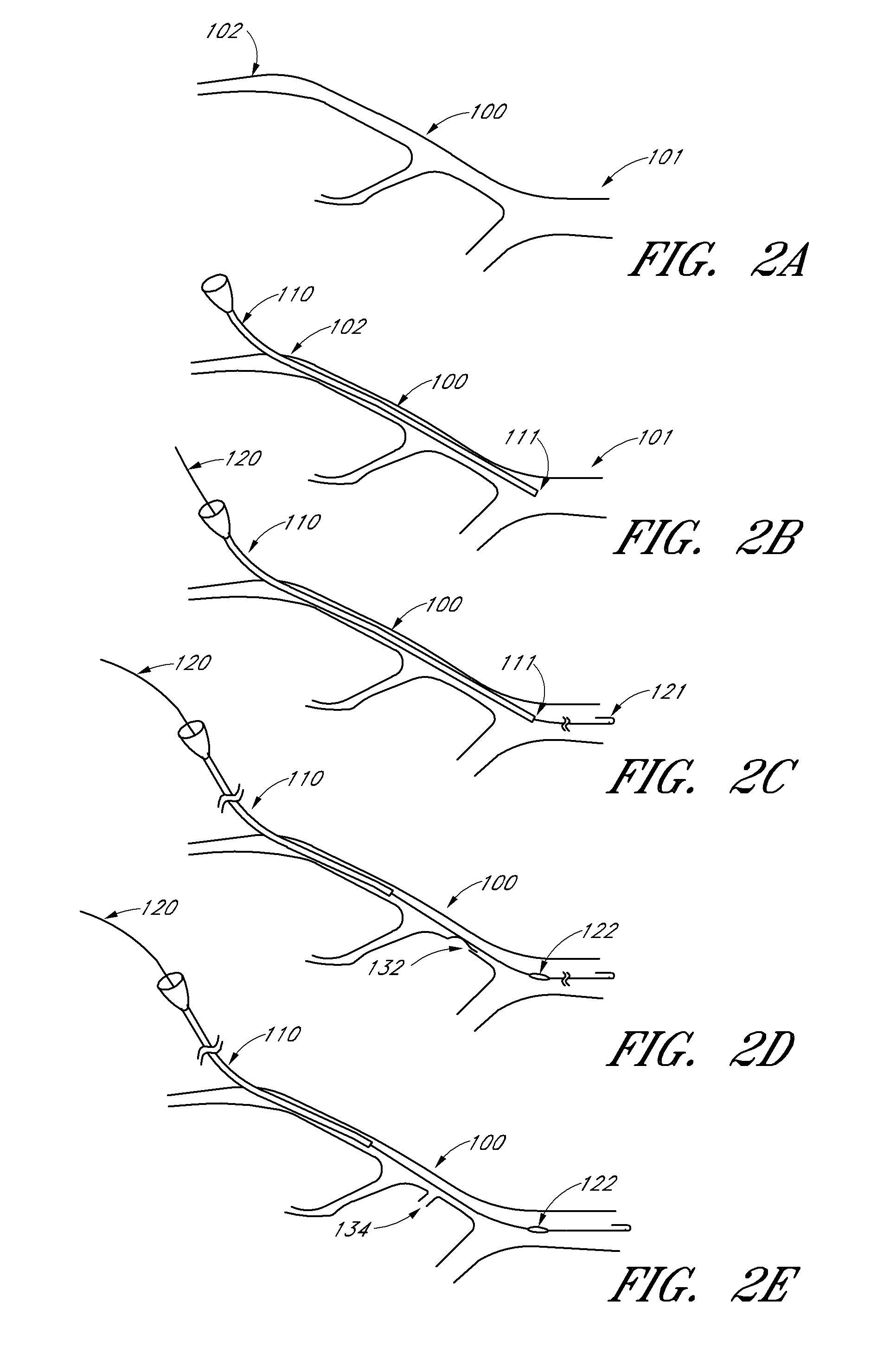 Method and devices for flow occlusion during device exchanges