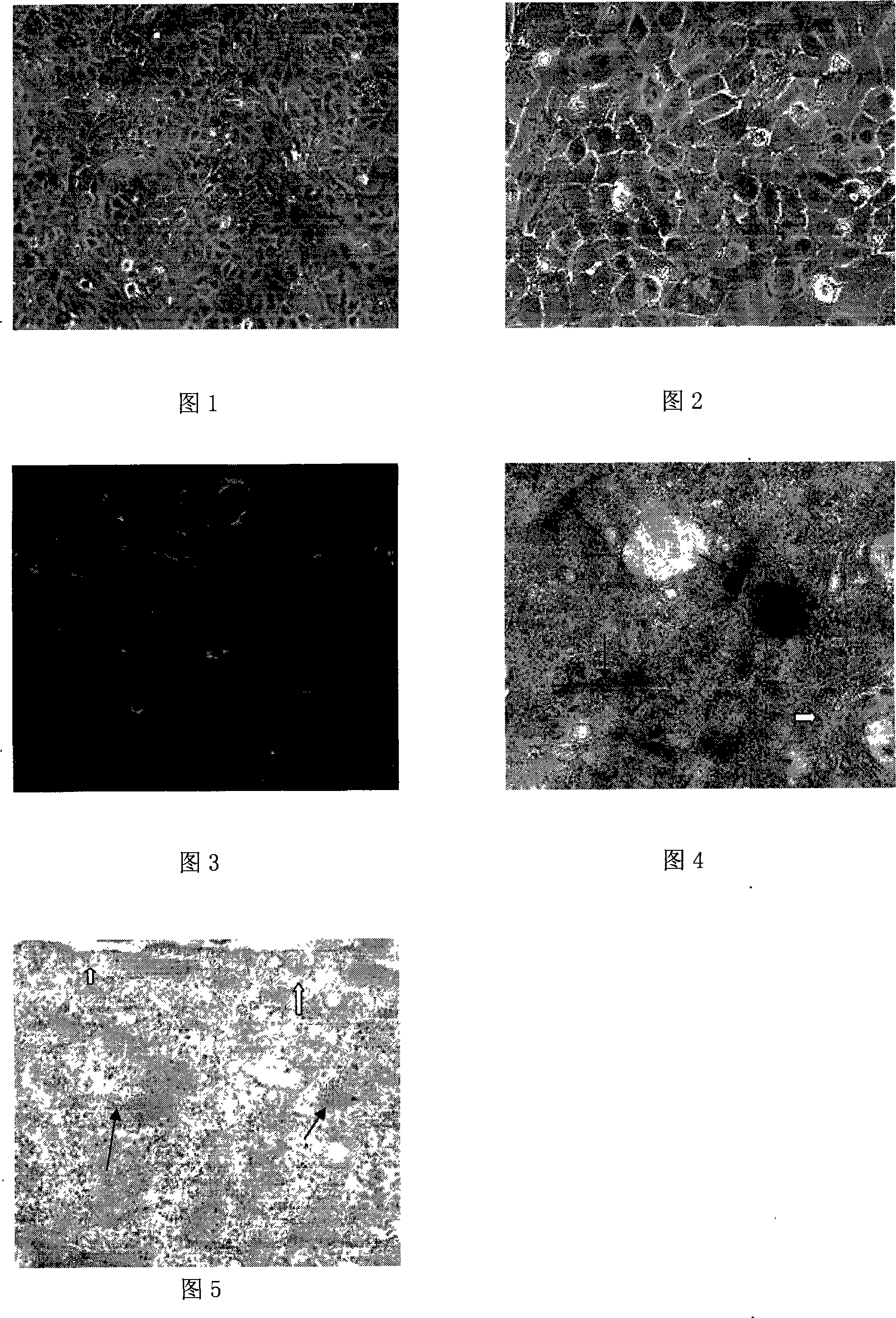 Method for culturing far-end pulmonary artery endothelial cell of rat