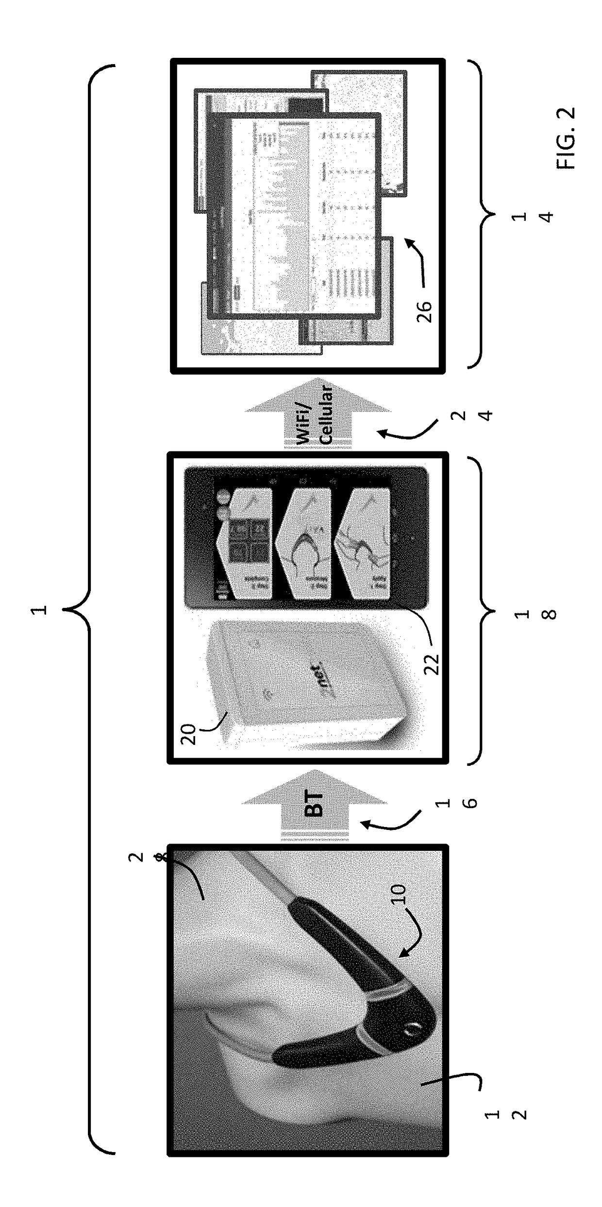 Neck-worn physiological monitor