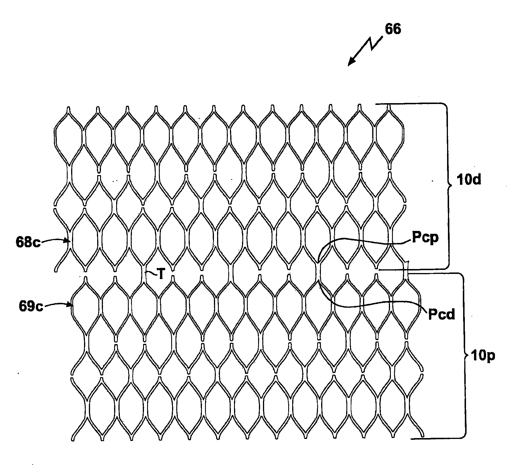 Multi-Segment Modular Stent And Methods For Manufacturing Stents