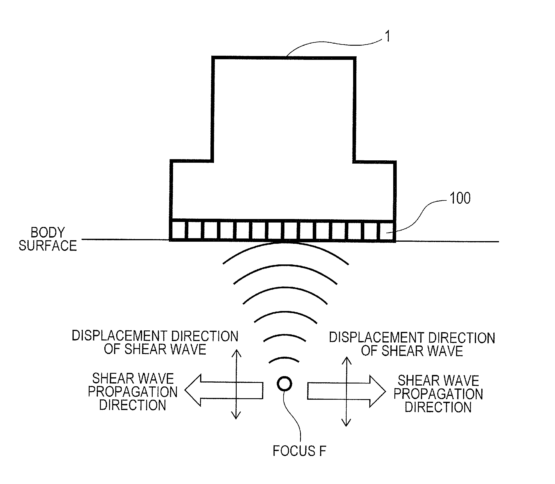 Ultrasound diagnosis apparatus