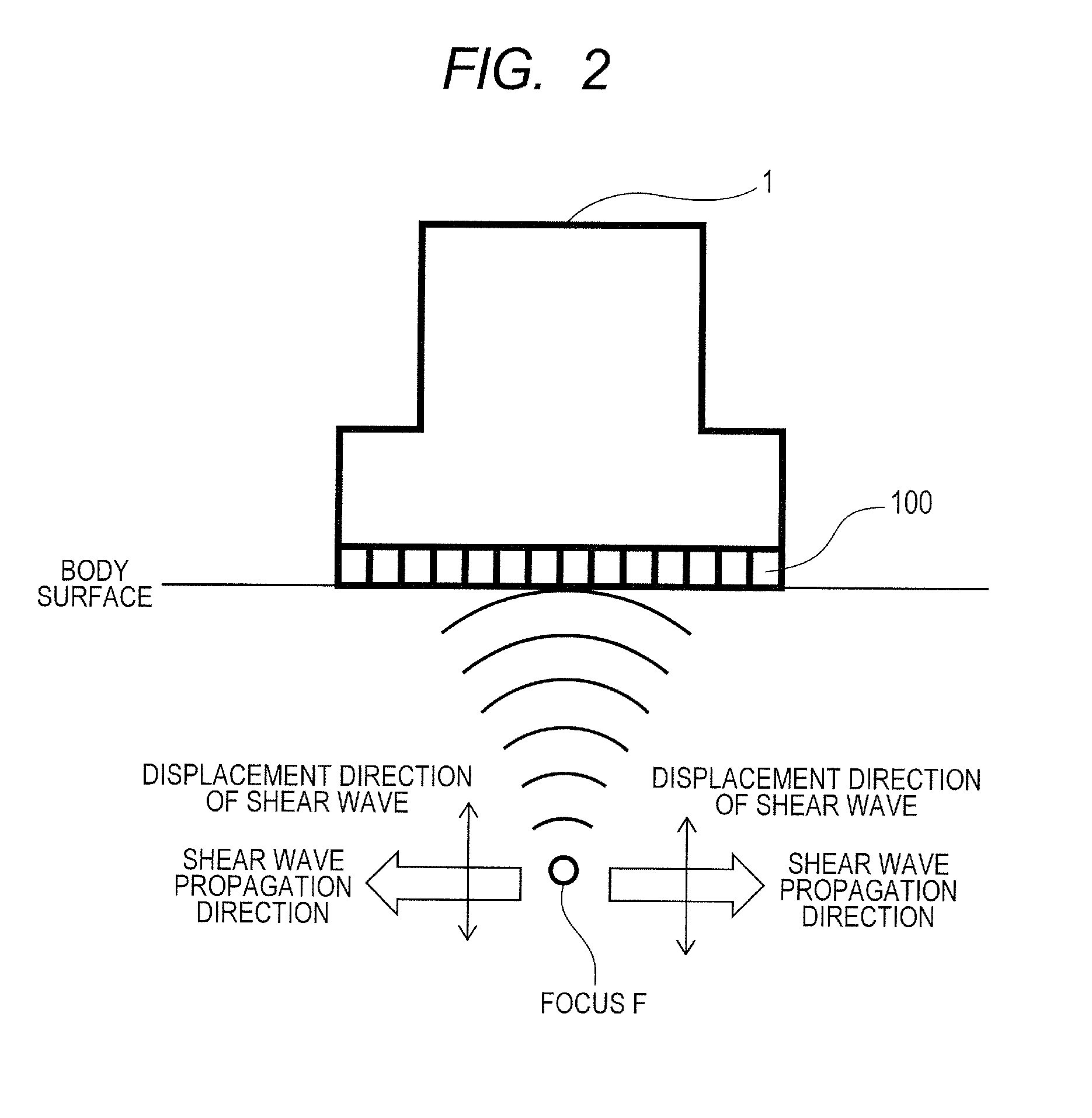 Ultrasound diagnosis apparatus