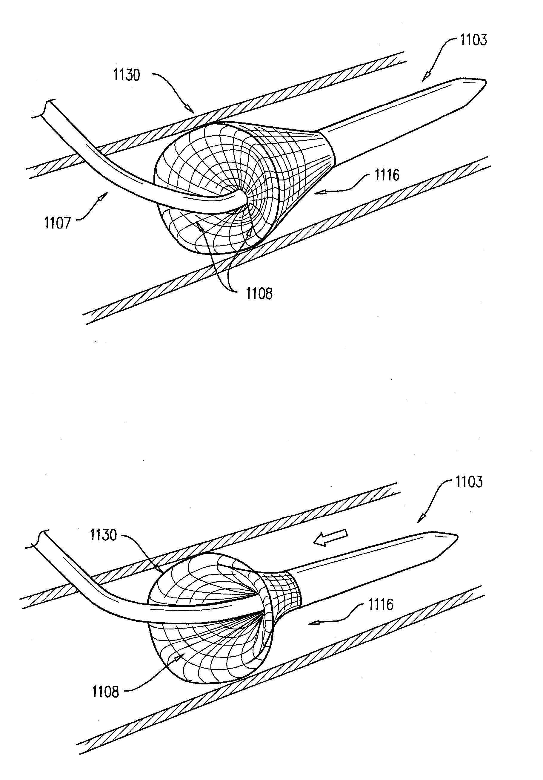 Intravascular device with multiple leaflets