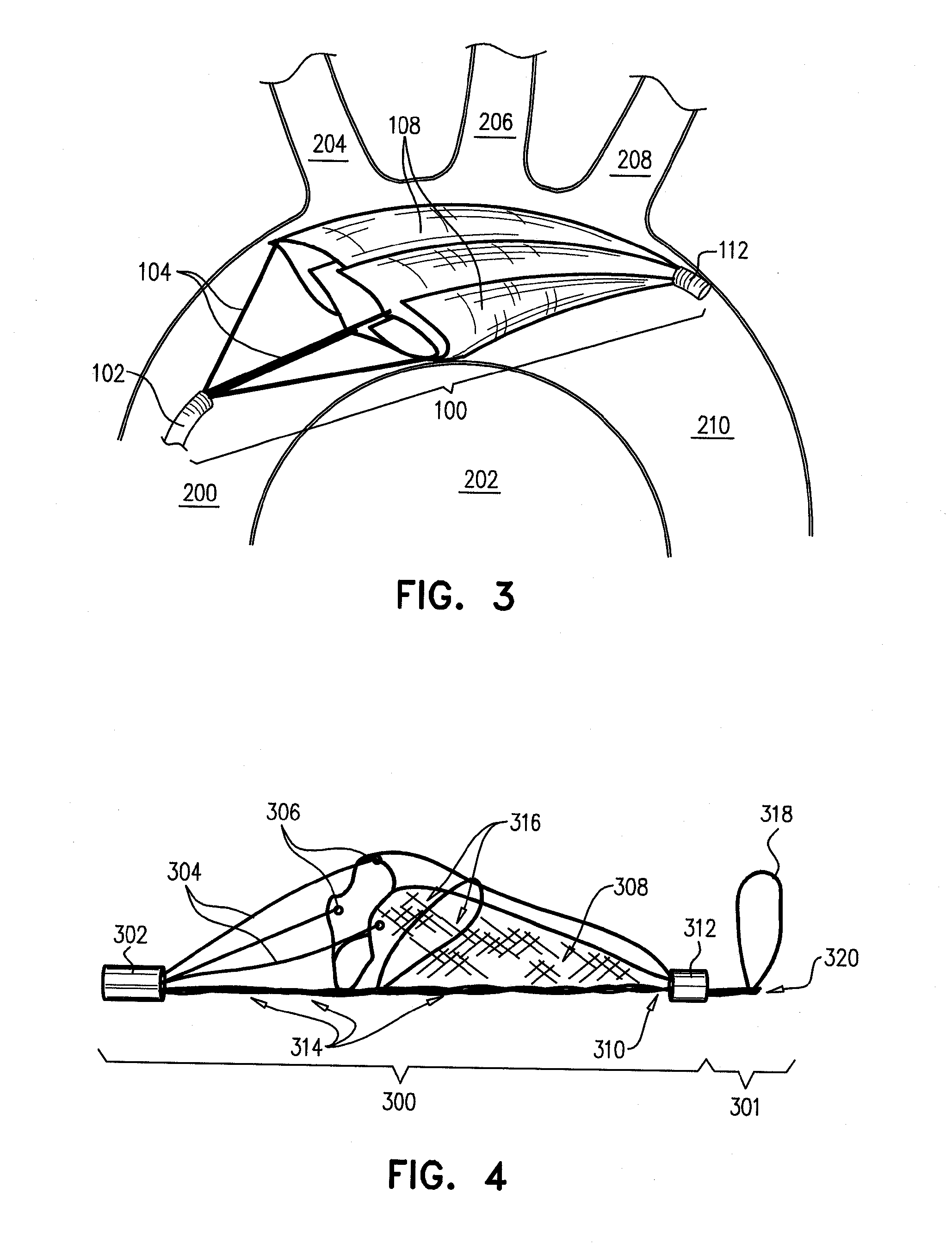 Intravascular device with multiple leaflets