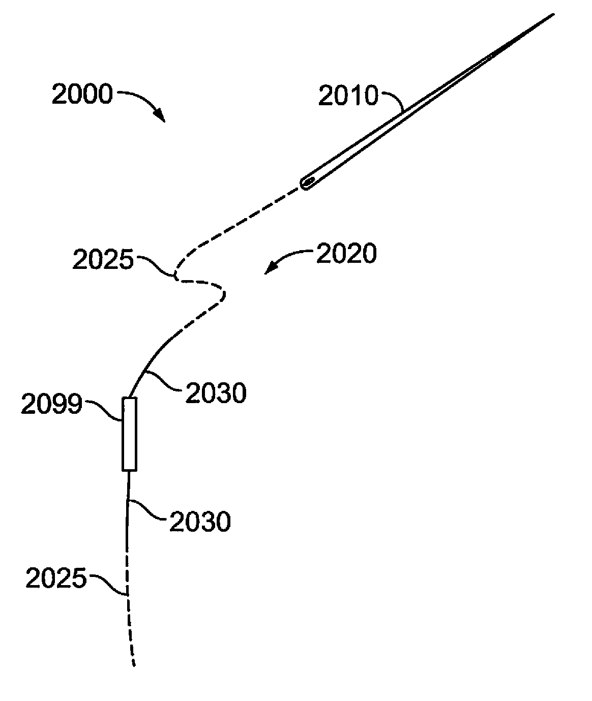 Apparatus for loading dosimetrically customizable brachytherapy carriers