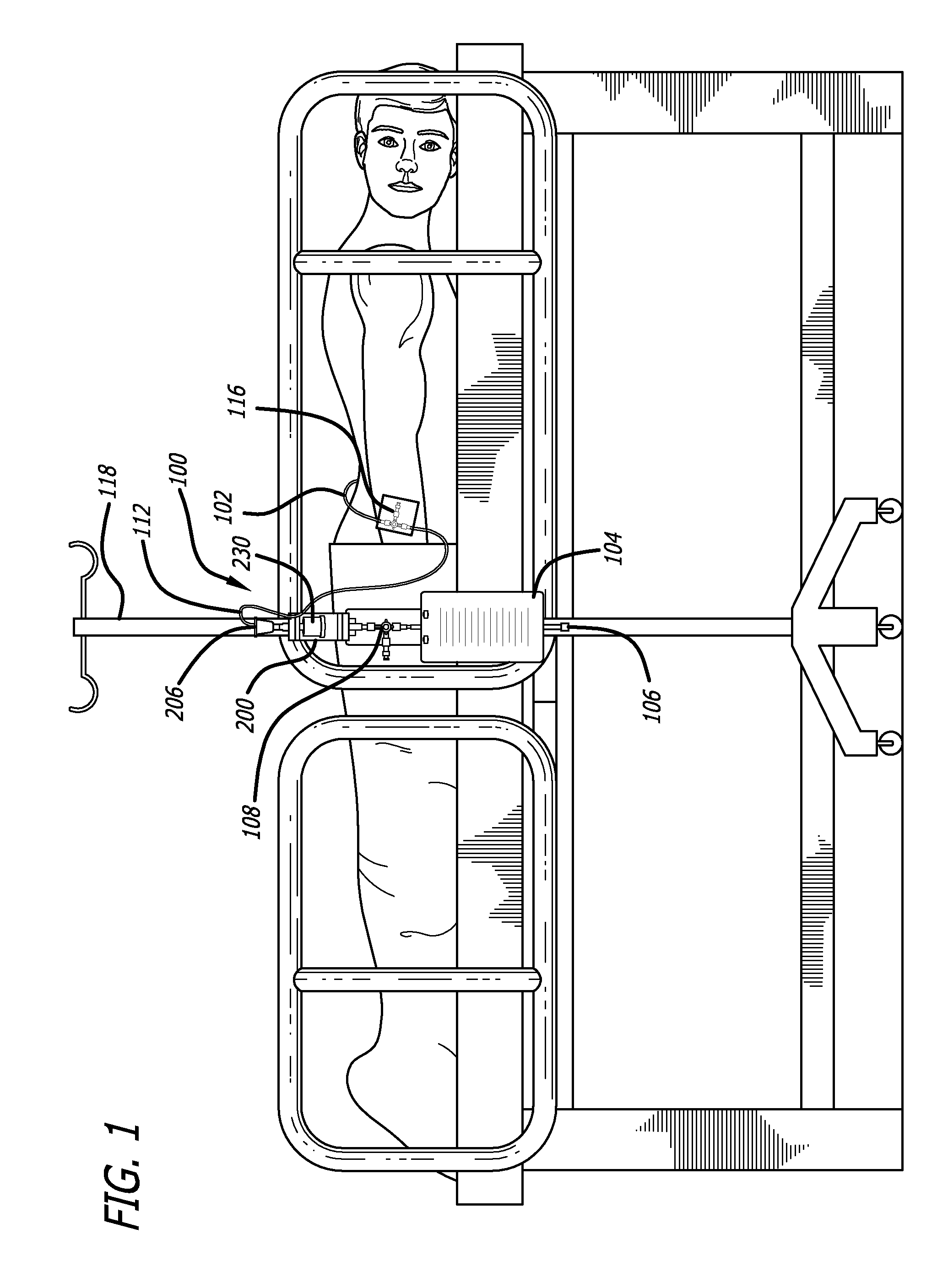 Volume limiting bodily fluid drainage system