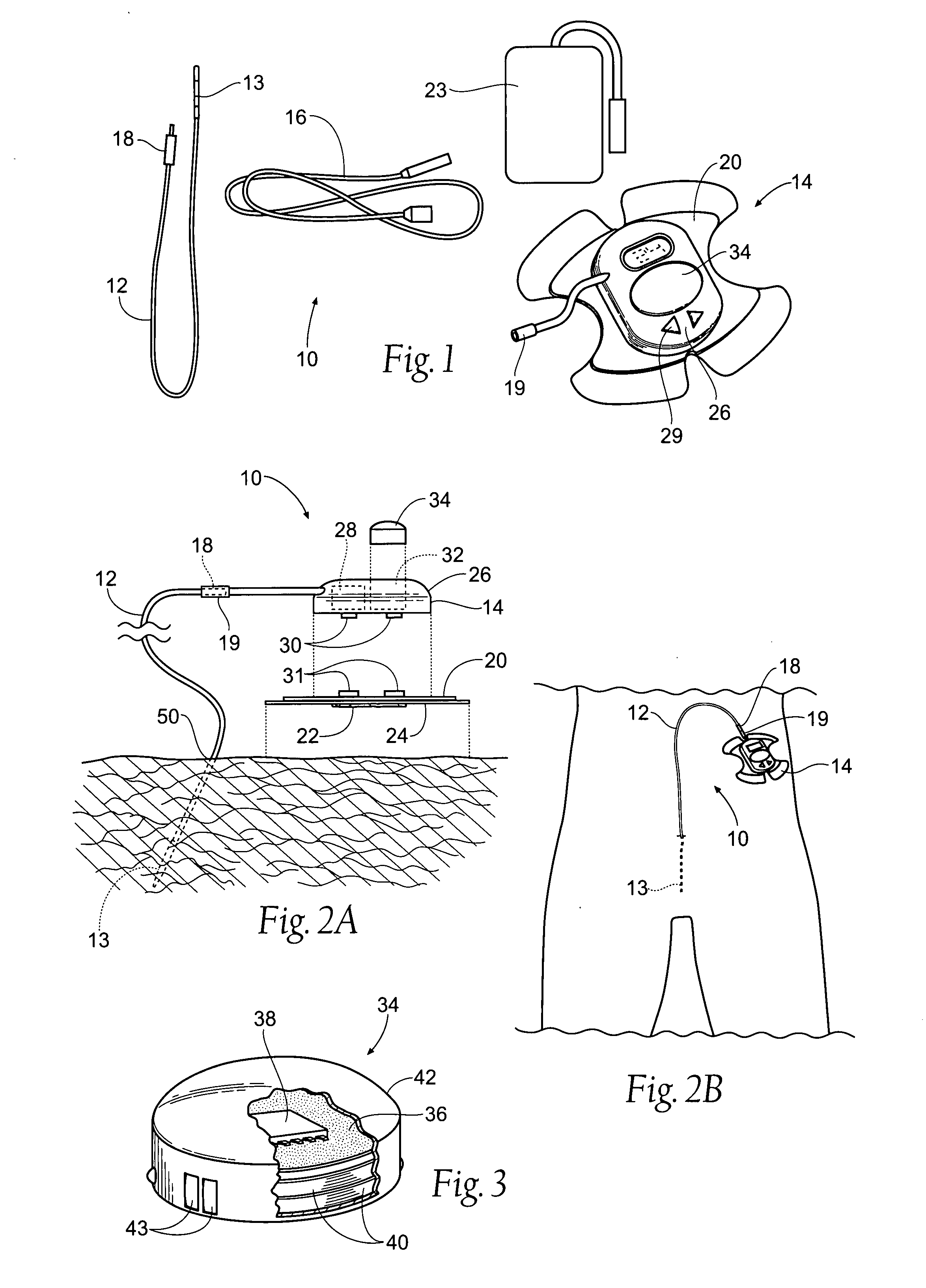 Systems and methods for a trial stage and/or long-term treatment of disorders of the body using neurostimulation