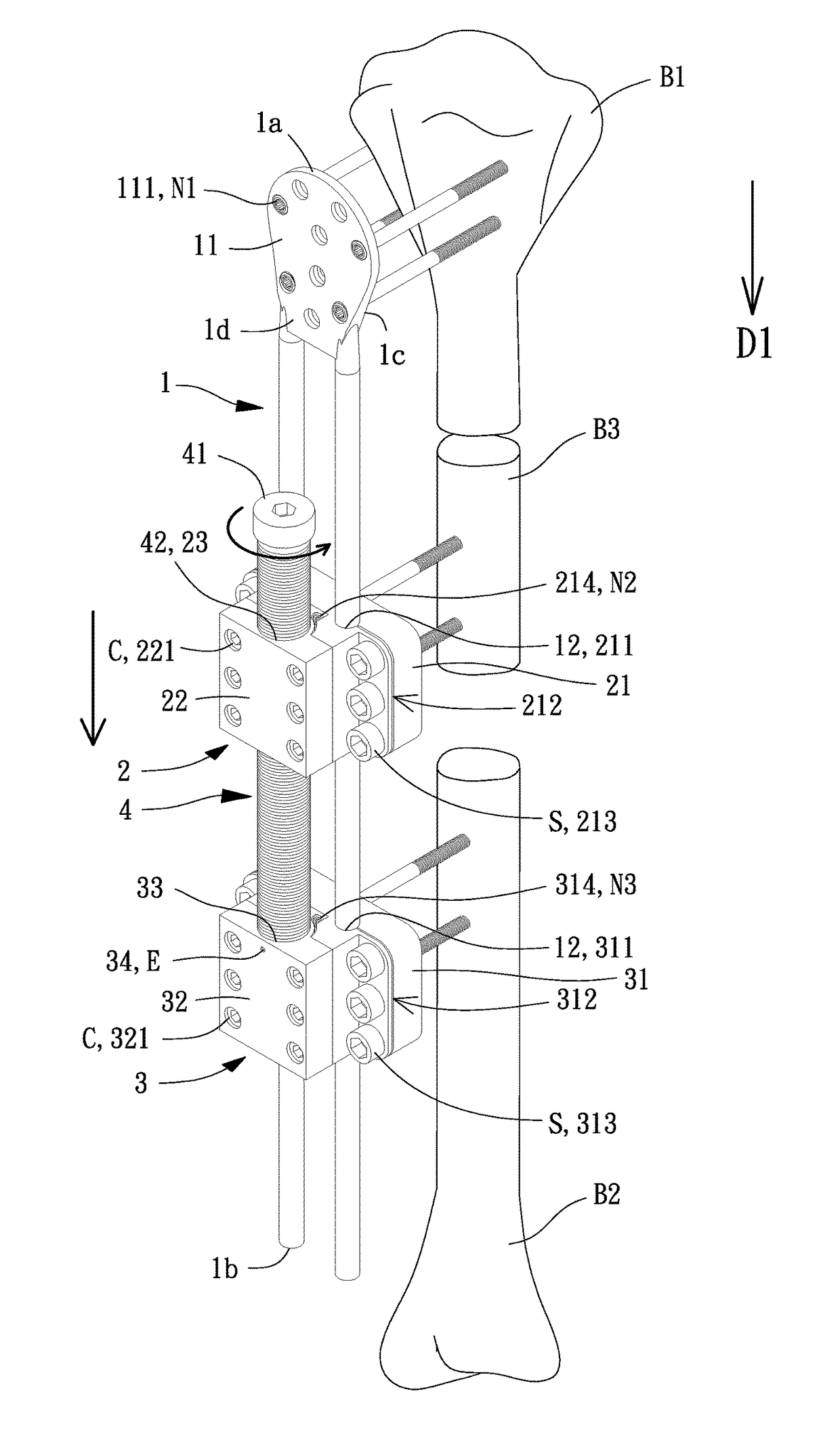 Adjustable External Fixator