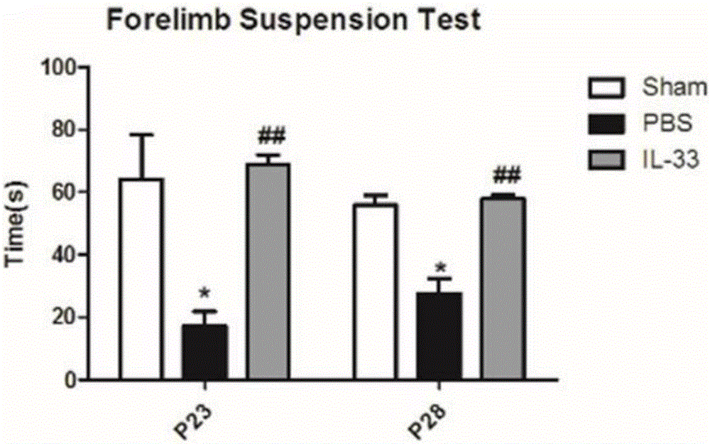 Application of interleukin33 in preparation of epilepsy treatment drugs