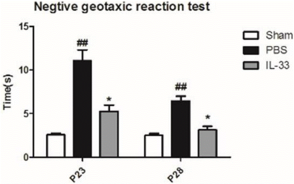 Application of interleukin33 in preparation of epilepsy treatment drugs