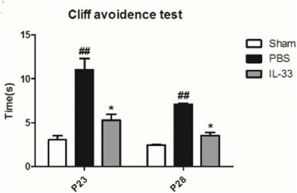 Application of interleukin33 in preparation of epilepsy treatment drugs