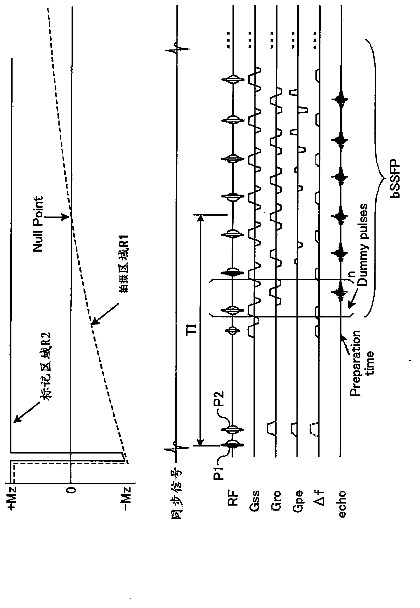 Magnetic resonance imaging apparatus and method