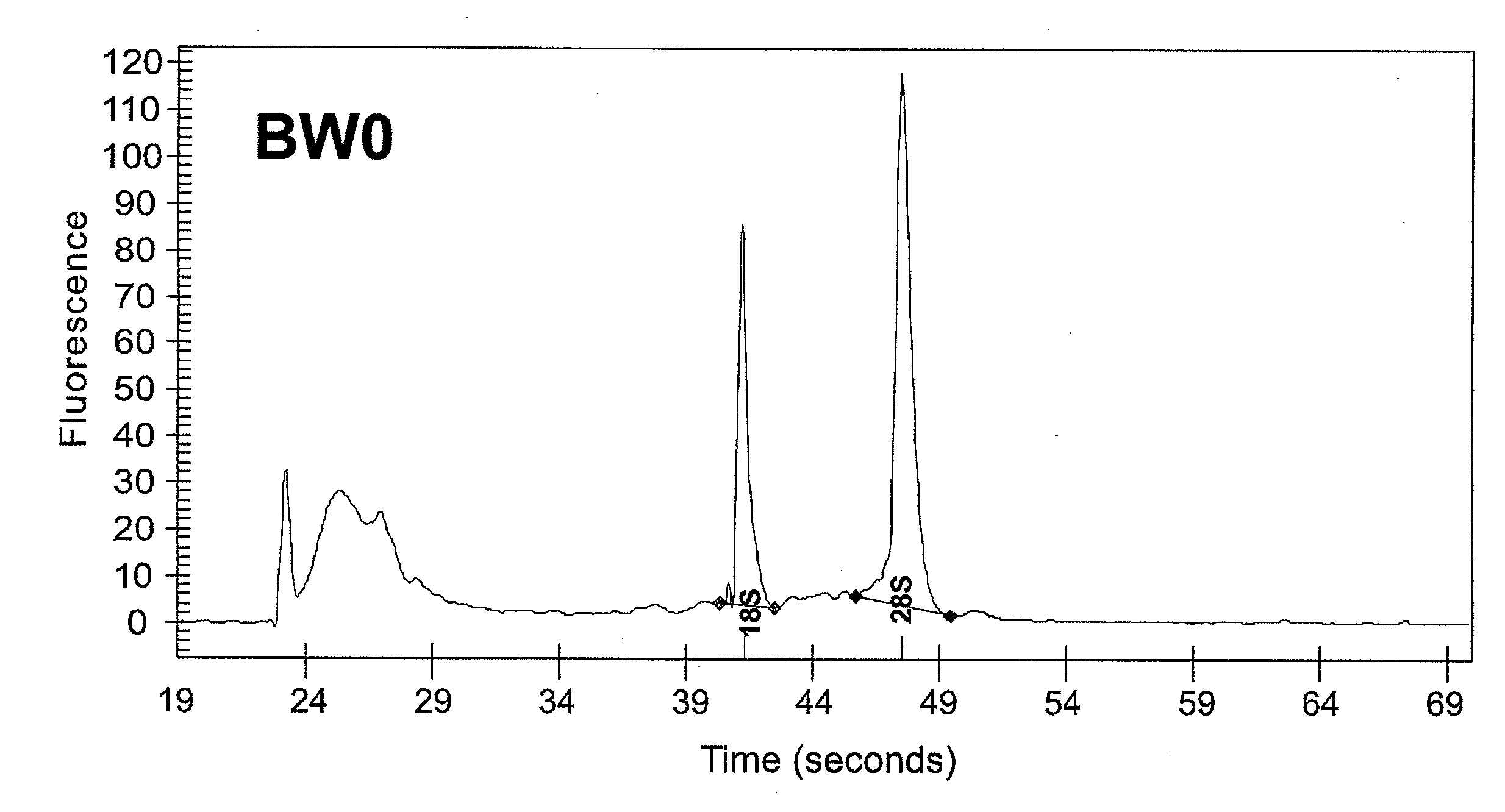 Bladder cancer diagnosis and/or prognosis method