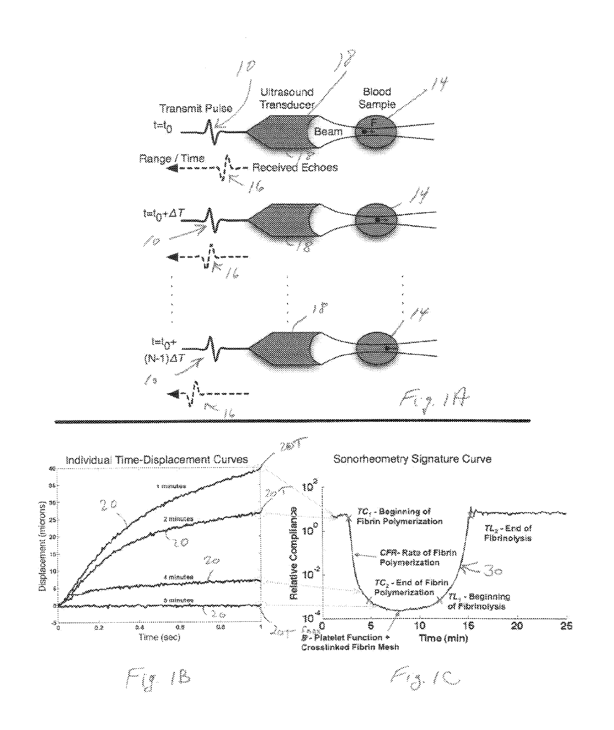 Ultrasound-based method and related system to evaluate hemostatic function of whole blood