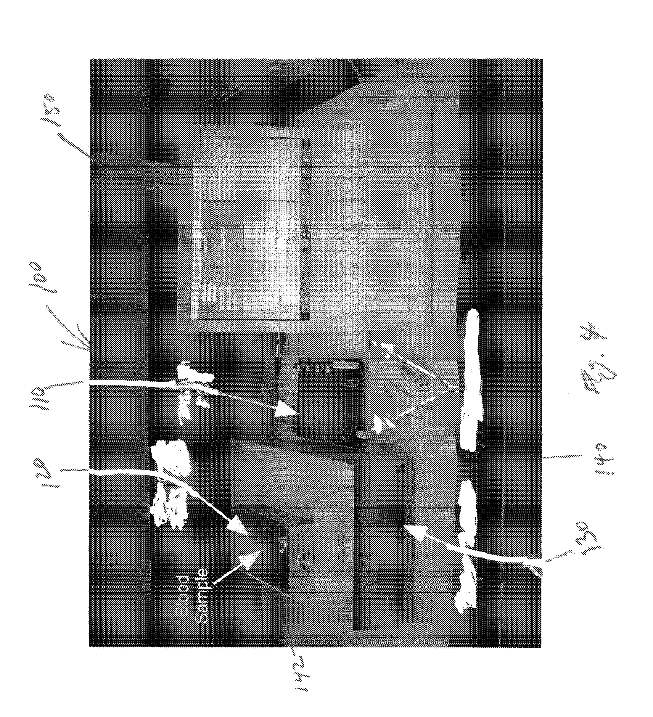 Ultrasound-based method and related system to evaluate hemostatic function of whole blood