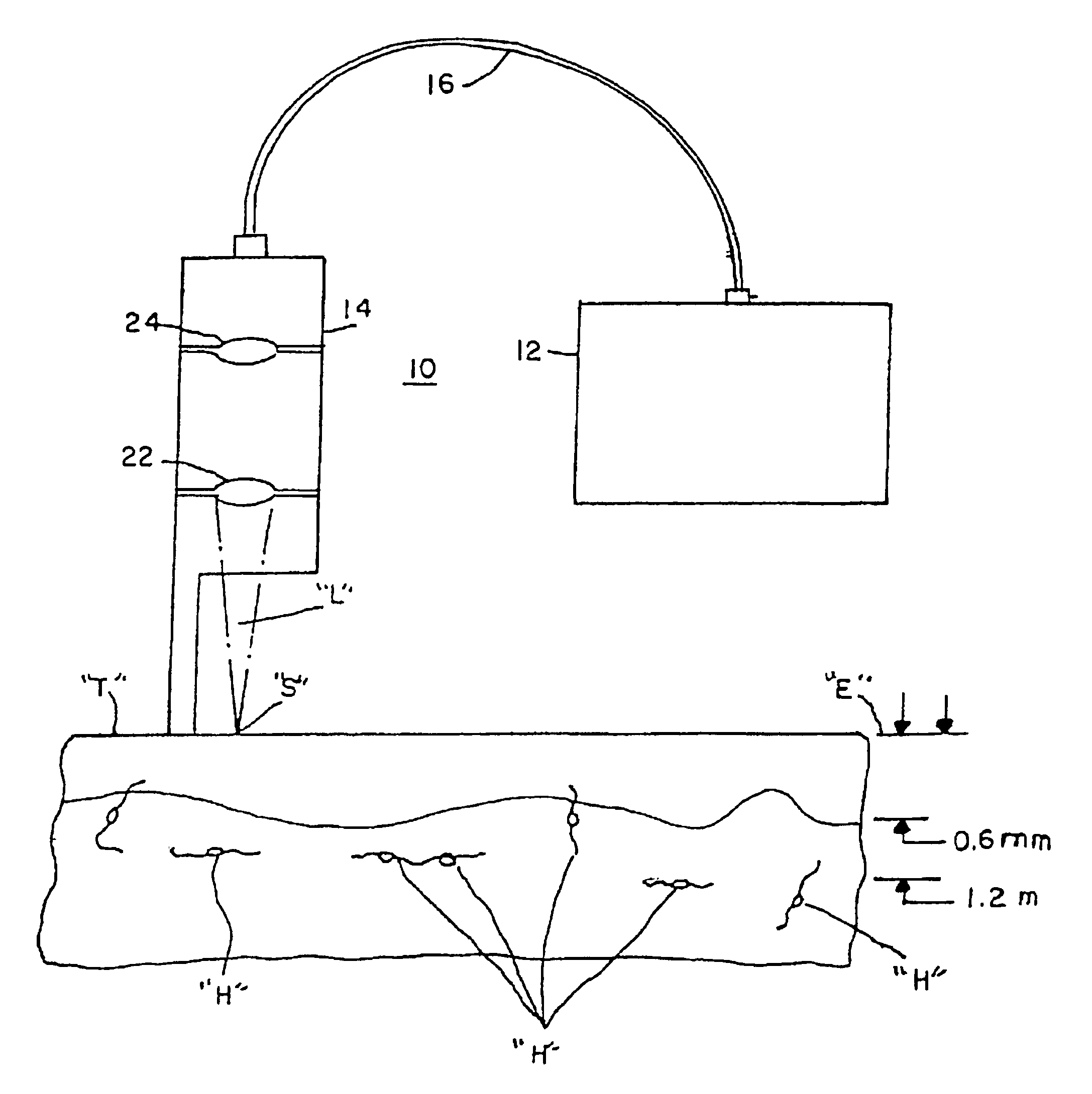 Method for non-invasive wrinkle removal and skin treatment