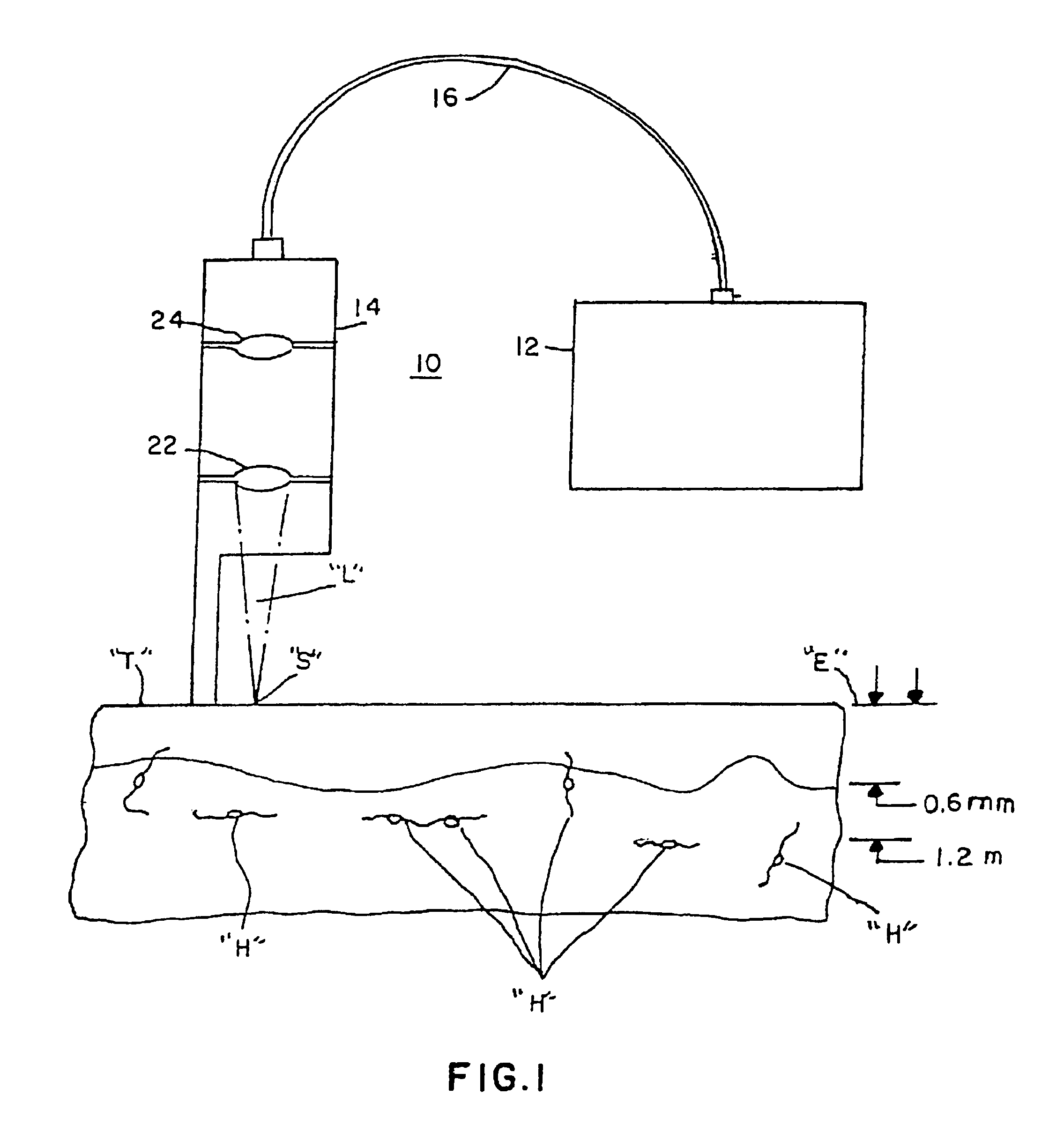 Method for non-invasive wrinkle removal and skin treatment