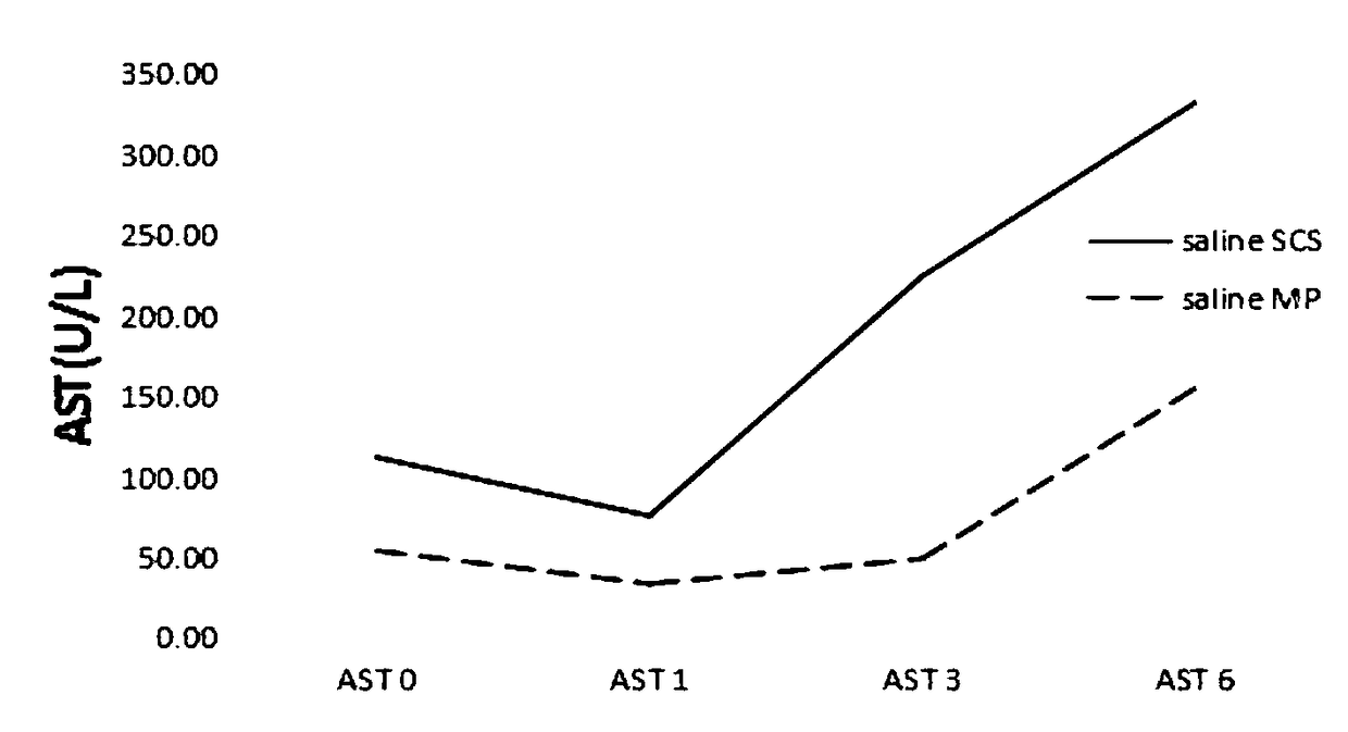 A kind of isolated liver perfusion system and isolated liver perfusion method