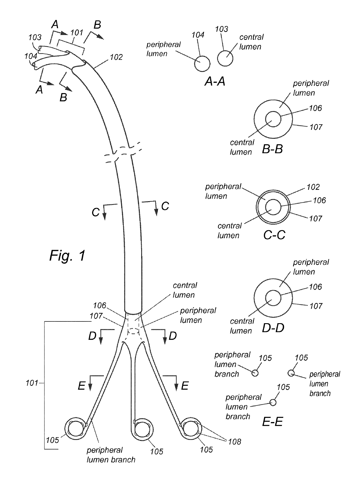 Pigtail for optimal aortic valvular complex imaging and alignment