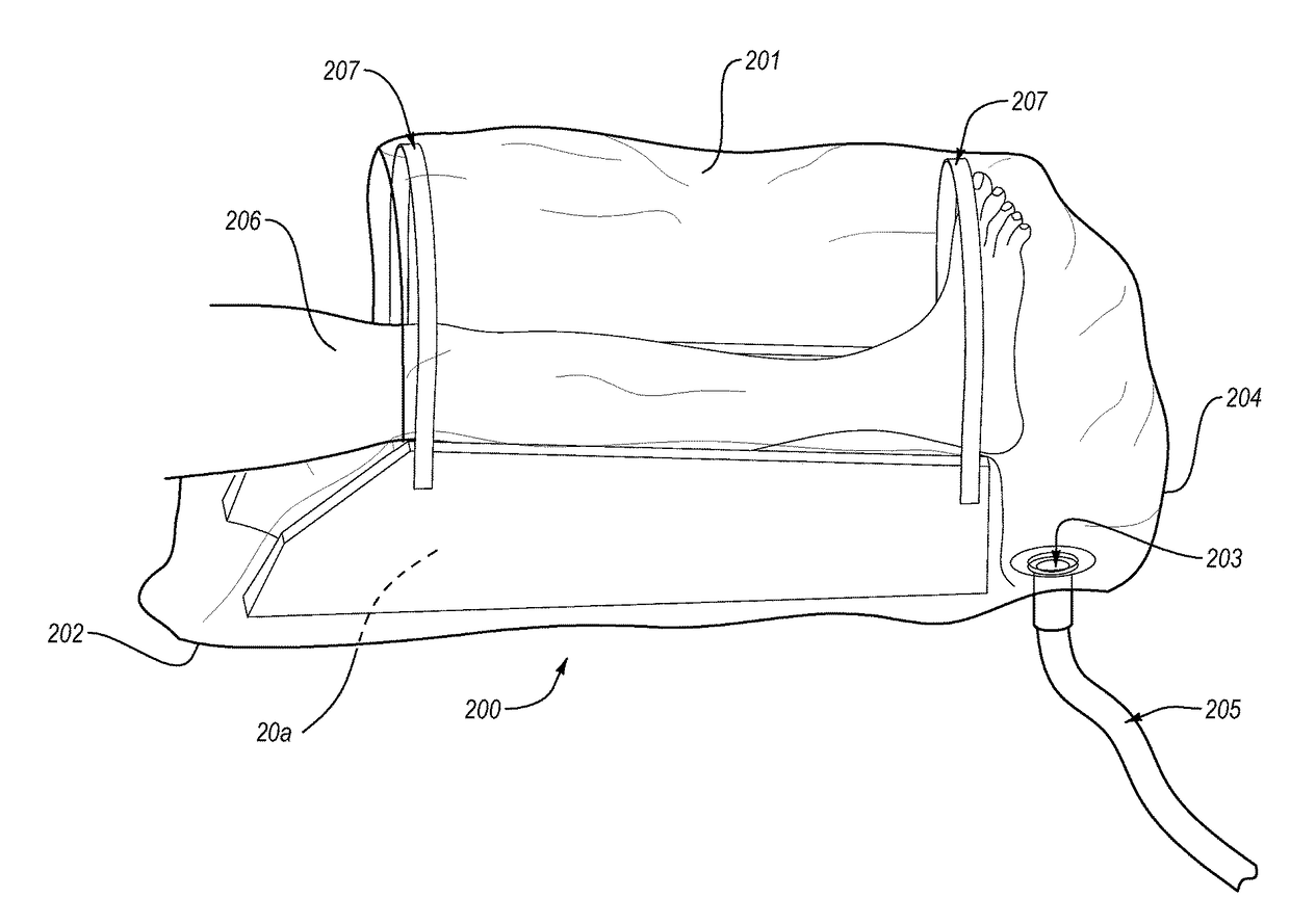 Extremity support and irrigation device and method of use