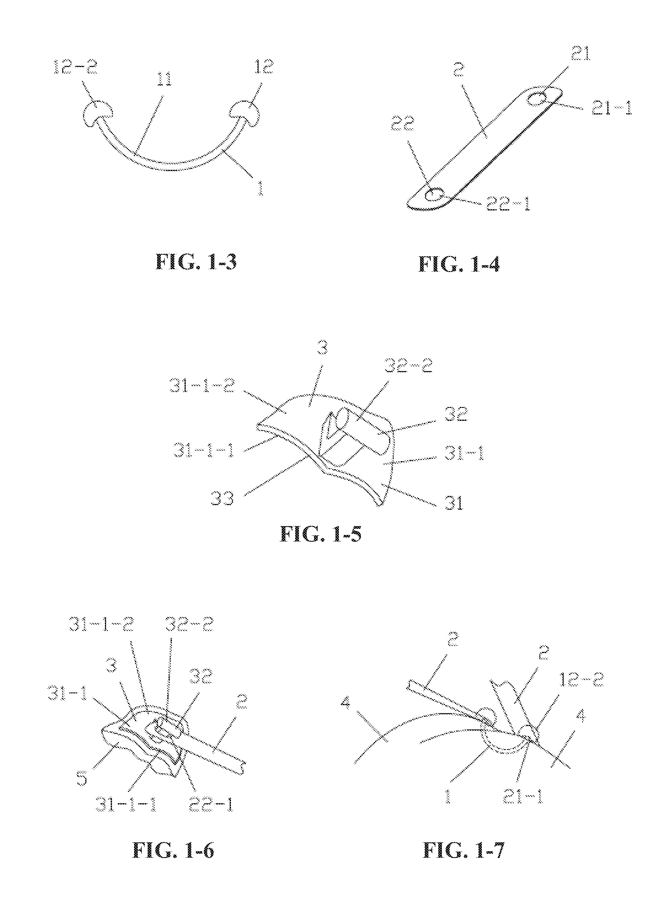 Elastic tongue-dorsum retraction device, clamping pliers, installation pliers, line guide and implantation method