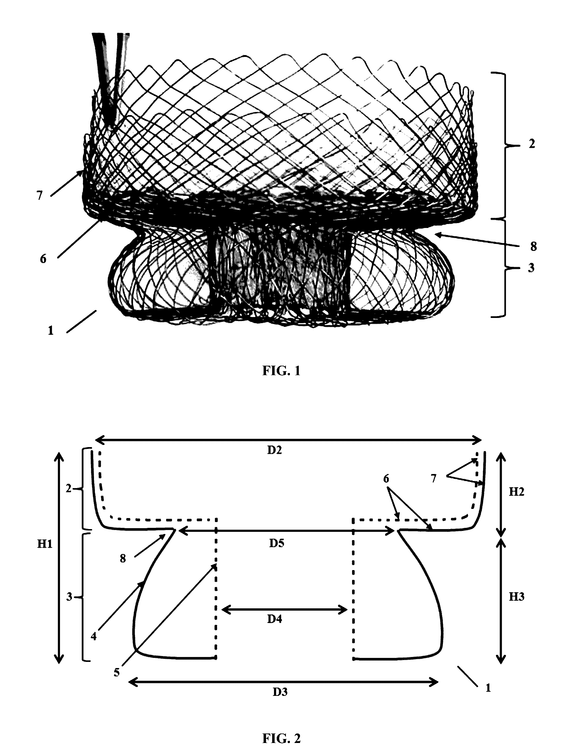 Heart valve anchoring device