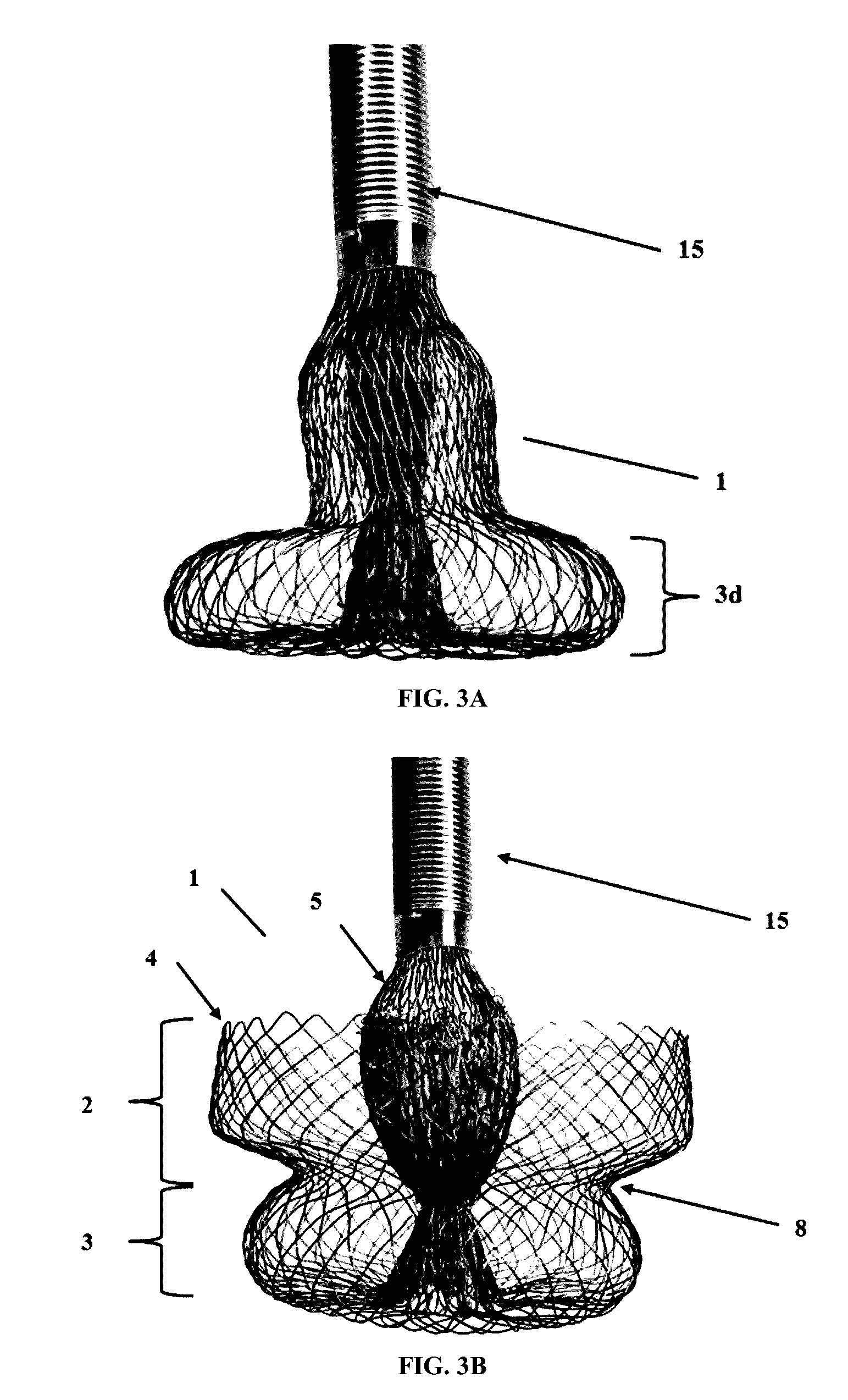 Heart valve anchoring device