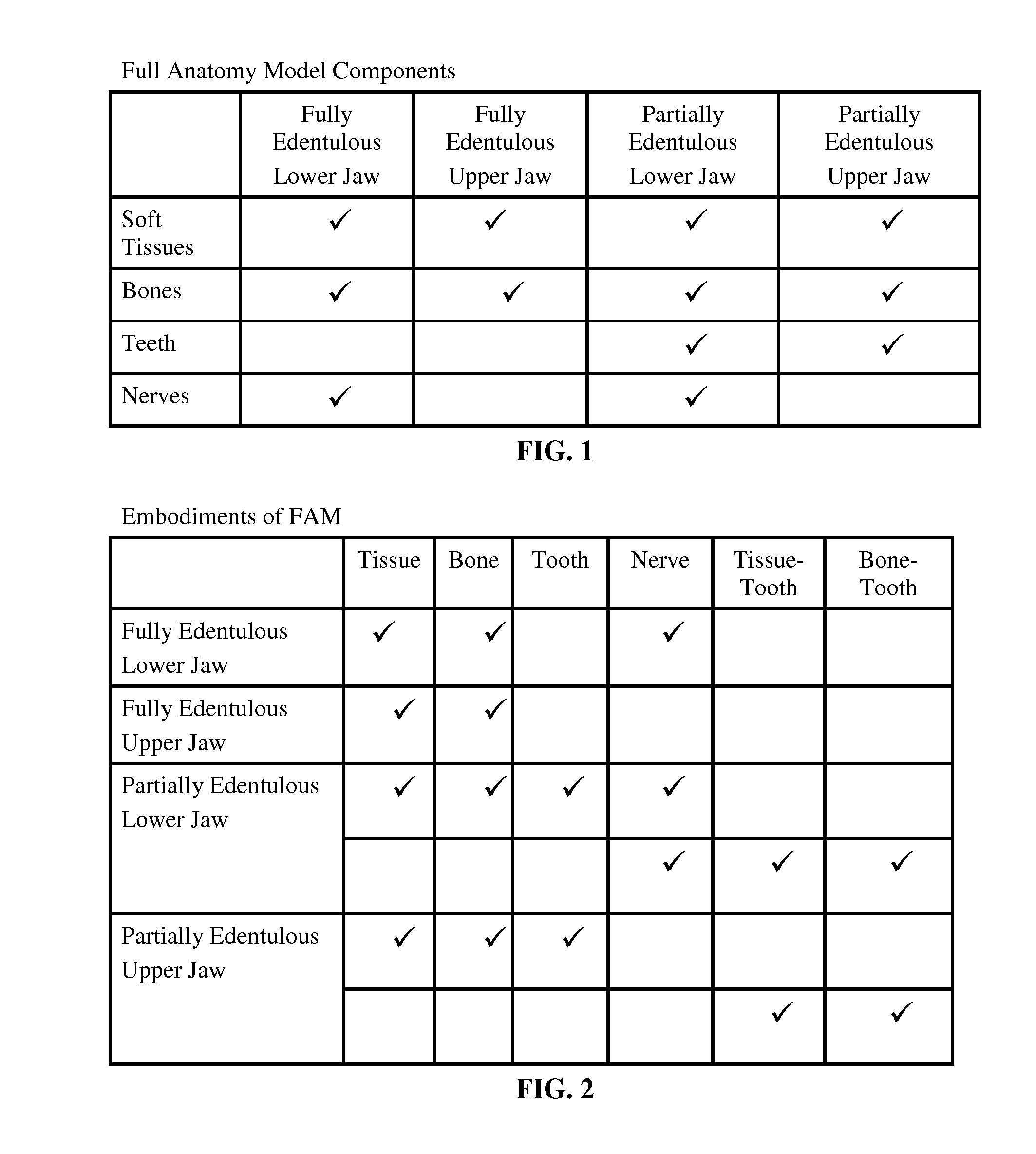 Method and system of anatomy modeling for dental implant treatment planning