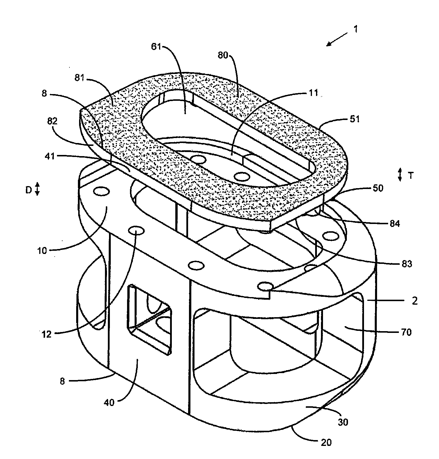 Composite implants having integration surfaces composed of a regular repeating pattern