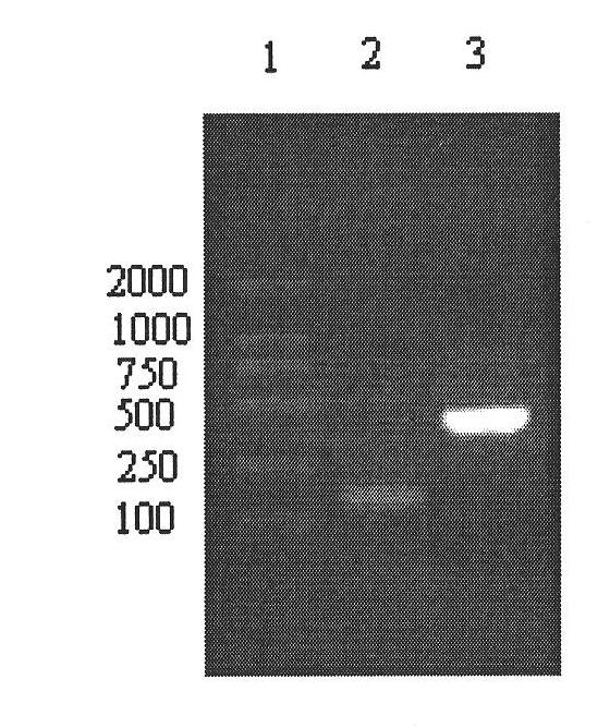 Expression method and application of fusion protein