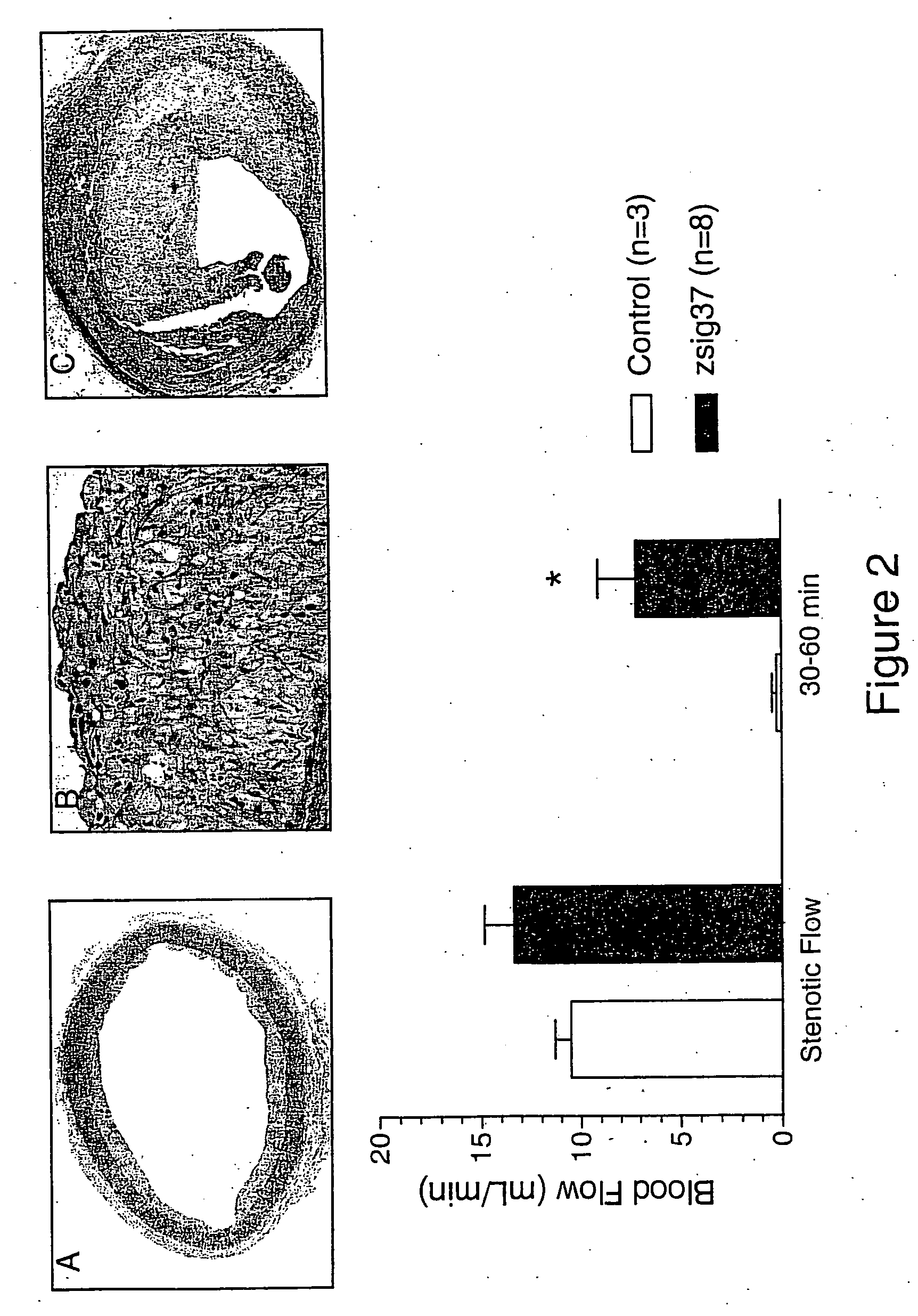 Inhibitors for use in hemostasis