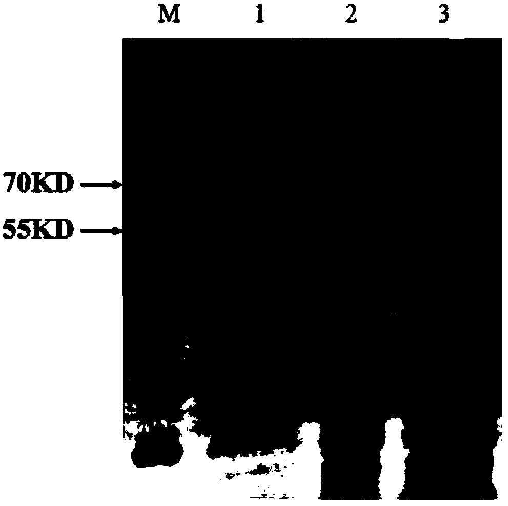 A P450 Oxidase and Its Gene Sequence of C. flaxensis