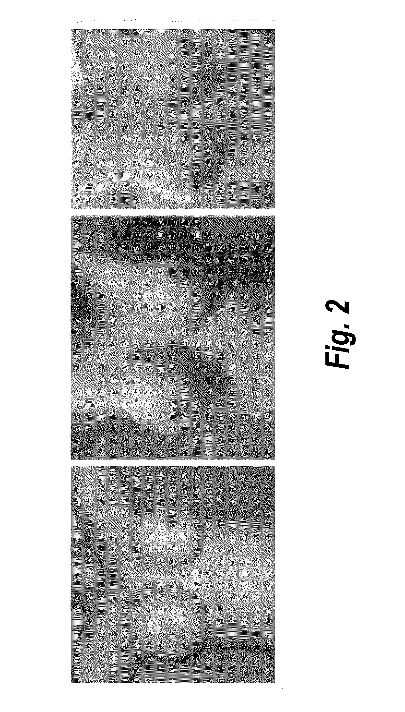 Process for the preparation of a pharmaceutical composition containing pirfenidone in sustained-release tablet form and its application in the regression of human chronic renal failure, breast capsular contracture and hepatic fibrosis