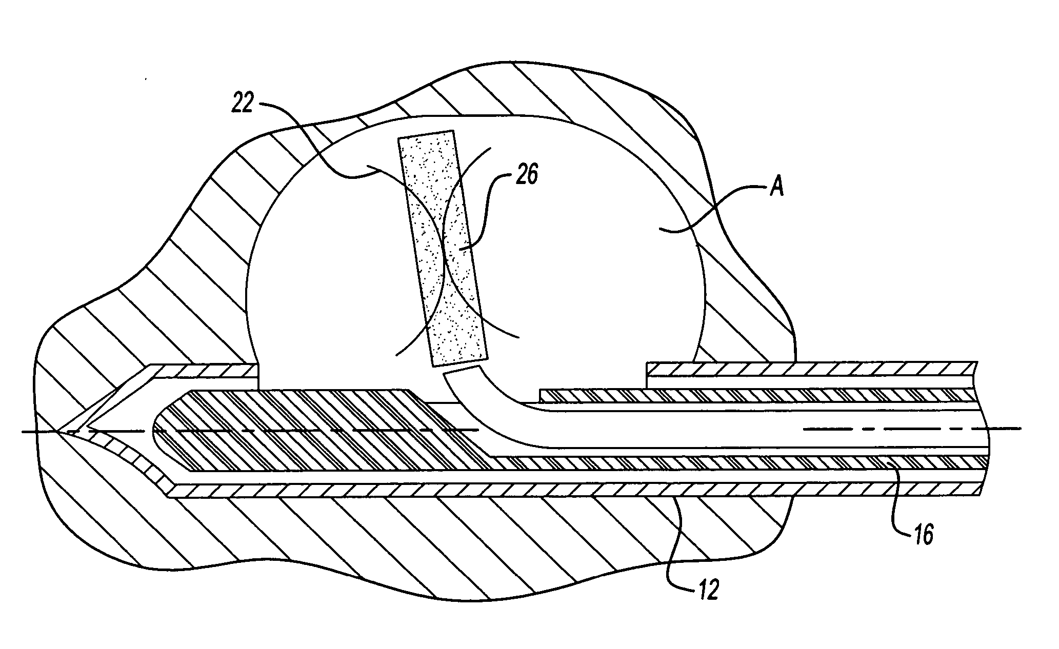 Biopsy devices and methods