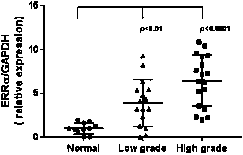 Use of estrogen-related receptor alpha as diagnostic marker for glioma and related application