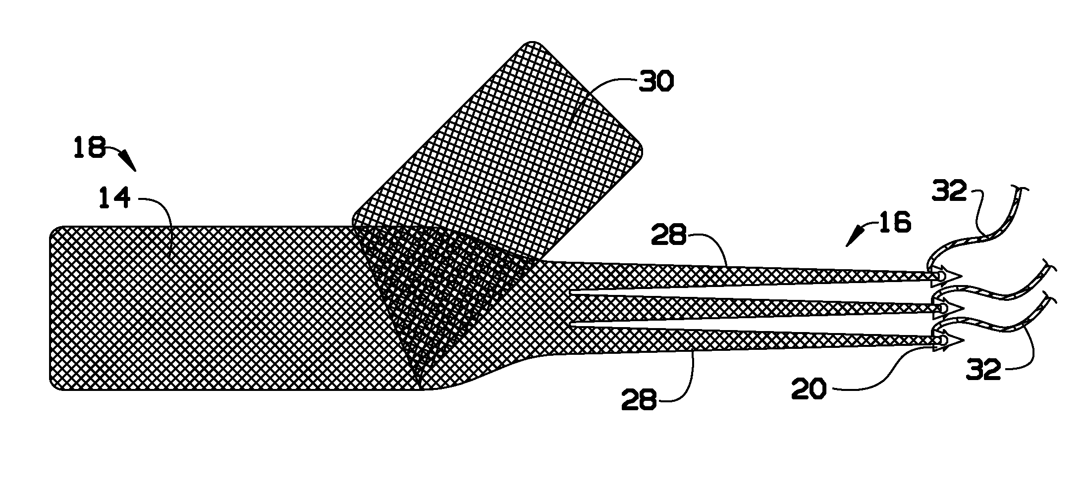 Surgical mesh for prolapse repair