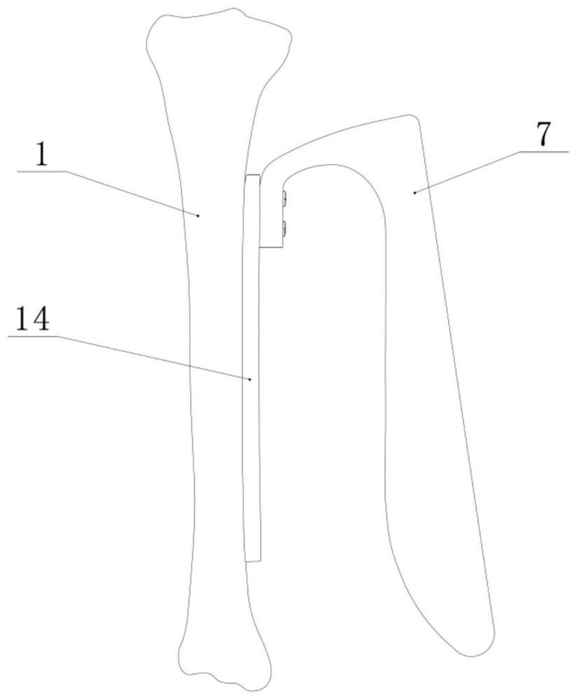 Navigation type minimally invasive bone setting system