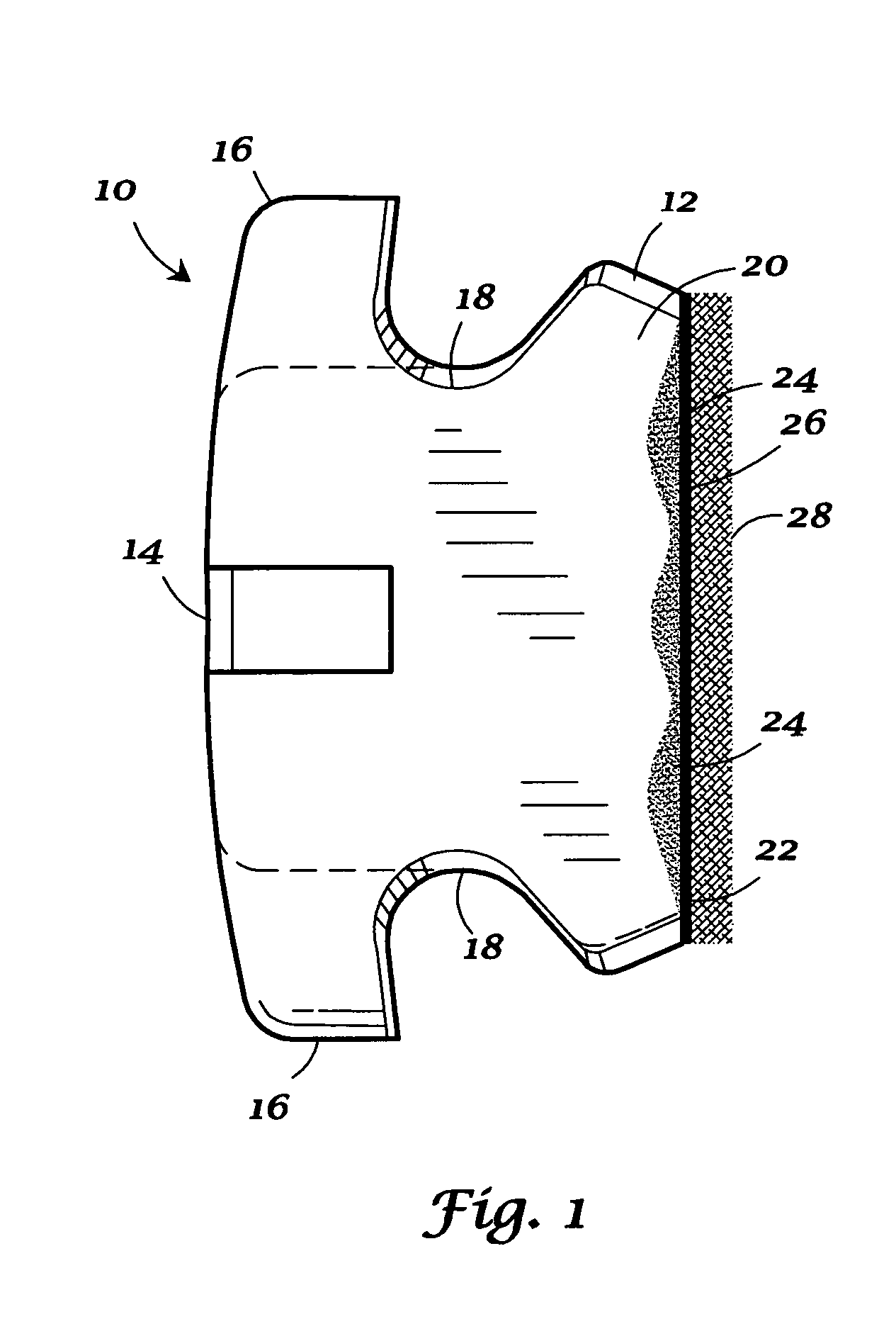 Methods for indirect bonding of orthodontic appliances