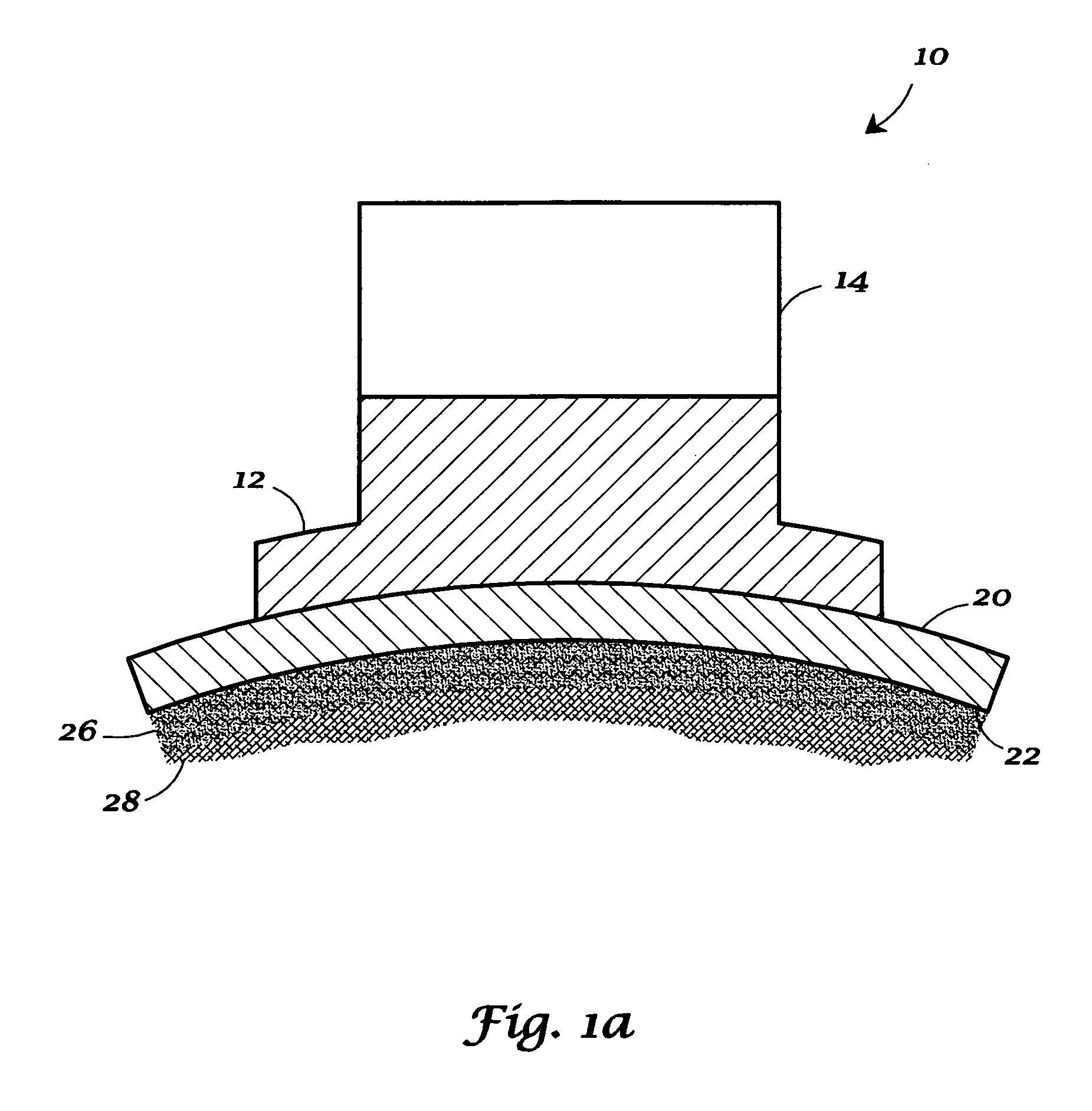 Methods for indirect bonding of orthodontic appliances