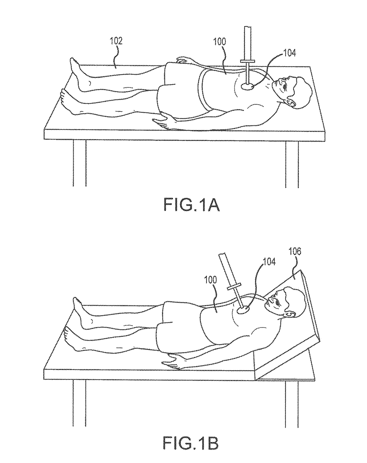 Elevation timing systems and methods for head up cpr