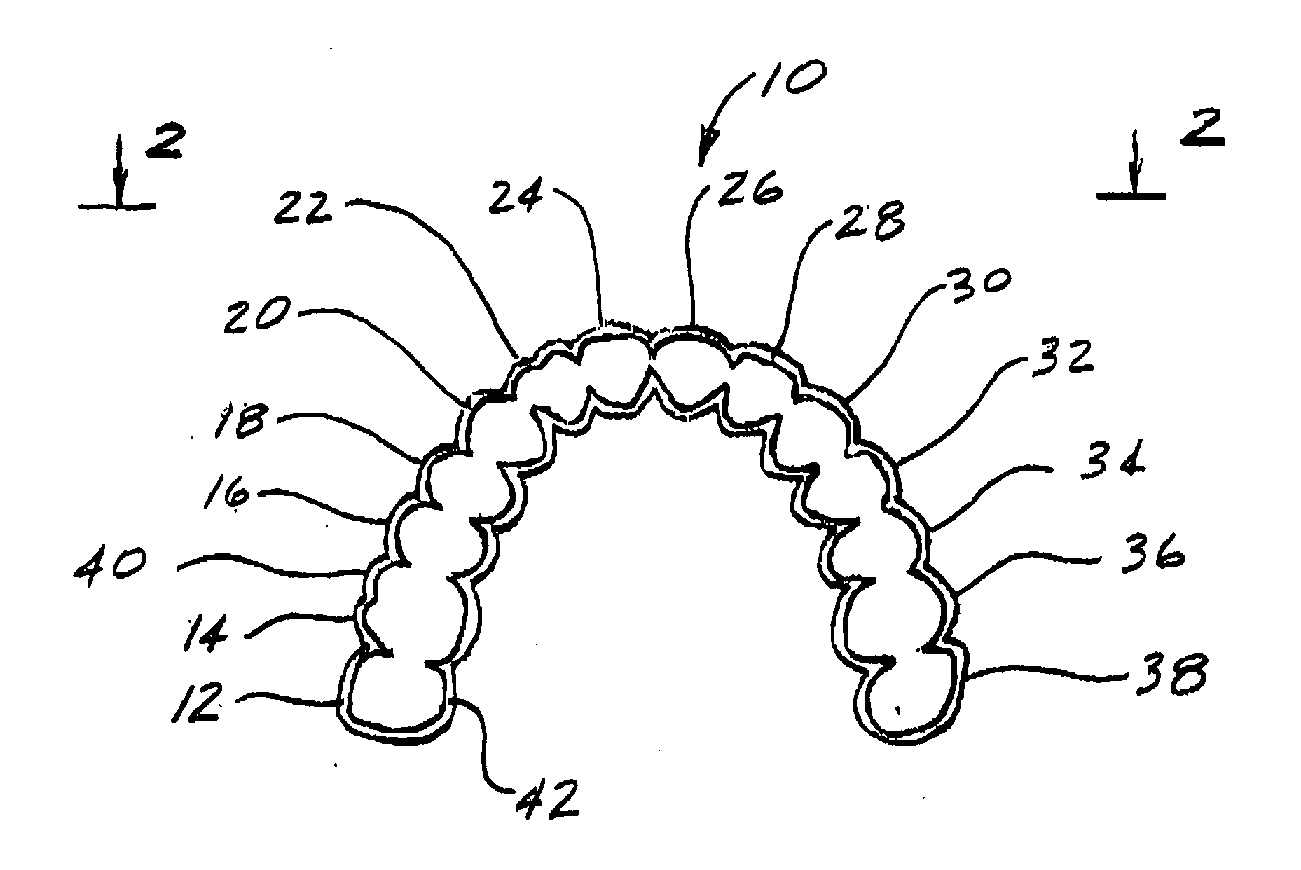 Dental appliance