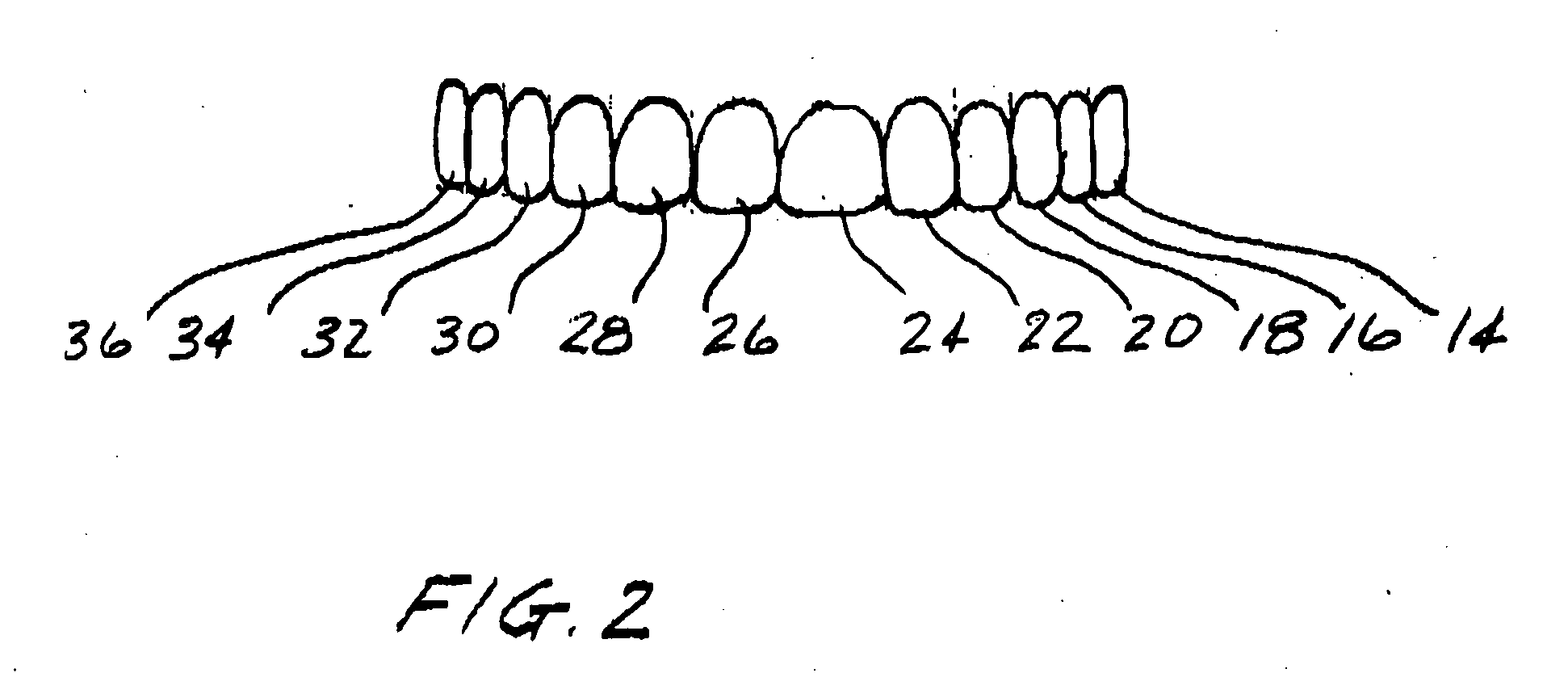 Dental appliance